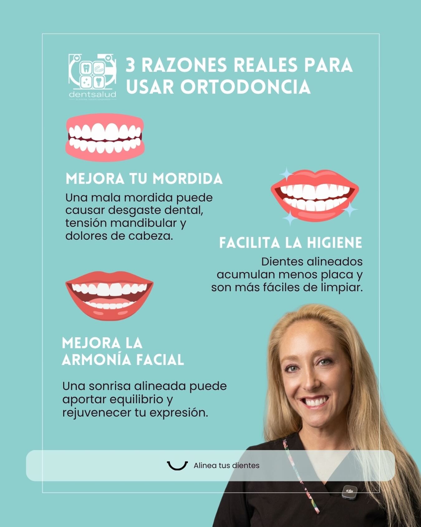 ✨ 3 razones reales para usar ortodoncia ✨
La ortodoncia va mucho más allá de tener una sonrisa bonita. Un tratamiento bien planificado puede mejorar tu salud oral, tu función masticatoria y la armonía de tu rostro.
🦷 Mejora tu mordida
Una mala mordida puede generar desgaste dental prematuro, sobrecarga muscular, molestias articulares e incluso dolores de cabeza.
🪥 Facilita tu higiene
Los dientes alineados son más fáciles de limpiar, disminuyendo la acumulación de placa y reduciendo el riesgo de caries y enfermedades de las encías.
😊 Mejora la armonía facial
Una sonrisa alineada contribuye al equilibrio facial, mejora la estética y puede ayudarte a sentirte más seguro al sonreír.
En Dentsalud creemos que una sonrisa sana es una inversión en bienestar y calidad de vida.
📍 Dentsalud 7 norte Viña del Mar
📞 Agenda tu evaluación y descubre cómo podemos ayudarte a sonreír con confianza.
#Autoligado #Invisalign #brackets #Spark #invisalign