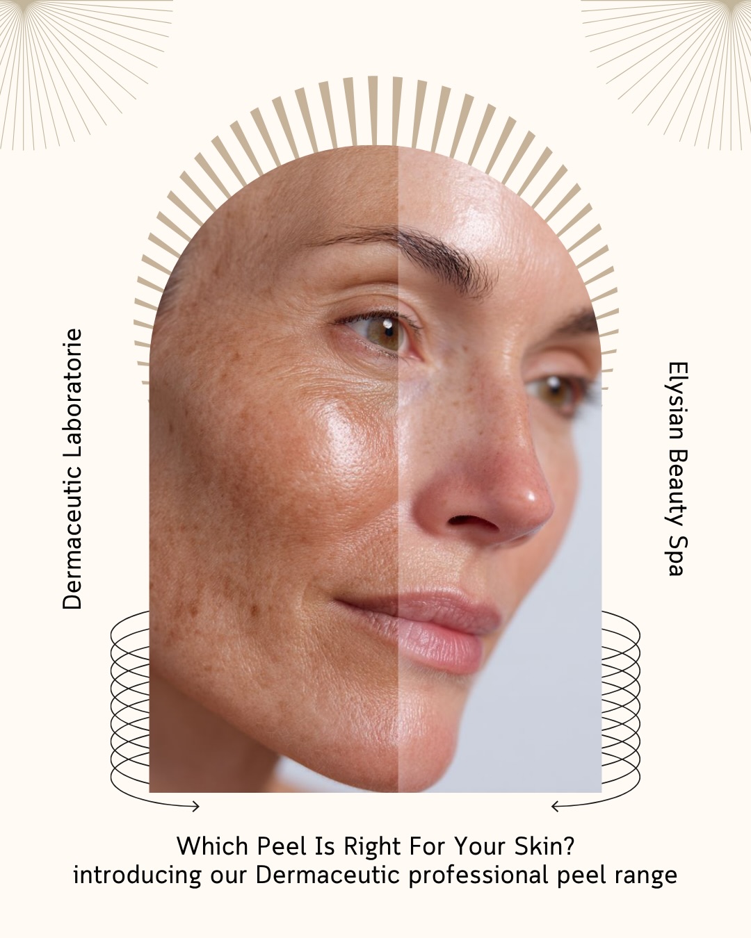 Not all peels are created equal ✨
Whether you’re looking to brighten dull skin, clear congestion, reduce breakouts or target stubborn pigmentation, our professional Dermaceutic peel range has a solution for you.
The best peel for your skin depends on your individual concerns, which is why every treatment begins with a professional skin consultation.
Ready to discover your perfect peel?
📍Elysian Beauty Spa 7/795 Canning Hwy, Applecross
📞 9364 9903 Book your skin consultation today
#ElysianSpa #Dermaceutic #ChemicalPeel #PerthSkinClinic #SkinRejuvenation