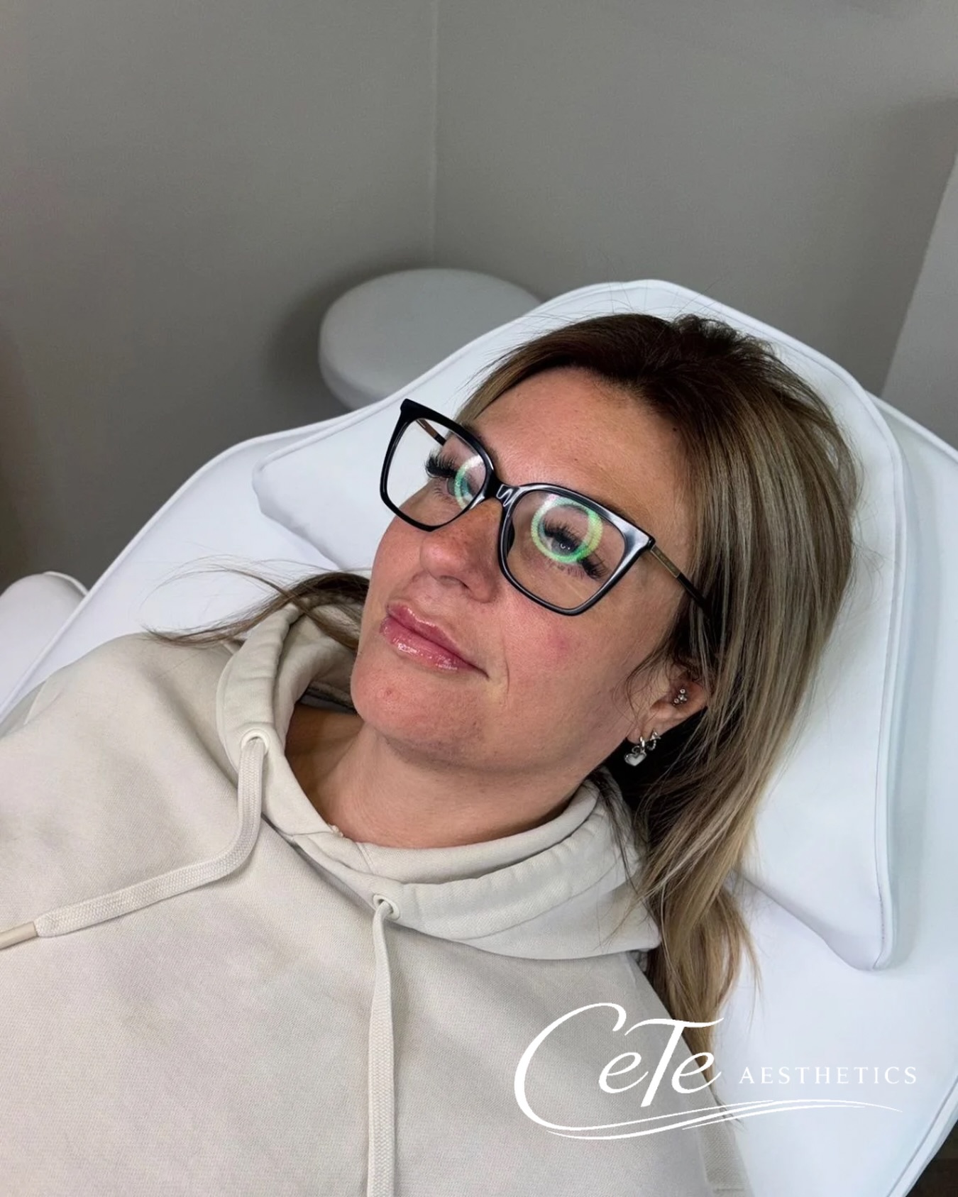 ๐ Subtle, Natural Lip Enhancement ๐
Our client wanted a little extra volume while keeping a soft, natural look โ and thatโs exactly what 0.5ml can achieve! โจ
This beautiful lip enhancement has added definition, improved symmetry, and created a fuller appearance without looking overdone. Sometimes less really is more! ๐
Perfect for anyone looking to:
โ๏ธ Enhance natural lip shape
โ๏ธ Add subtle volume
โ๏ธ Improve definition and hydration
โ๏ธ Achieve a fresh, natural-looking result
Results are immediate, with full settling taking place over the next couple of weeks. ๐โจ
Ready to enhance your lips with a treatment tailored to you? Send us a DM to book your consultation. ๐
