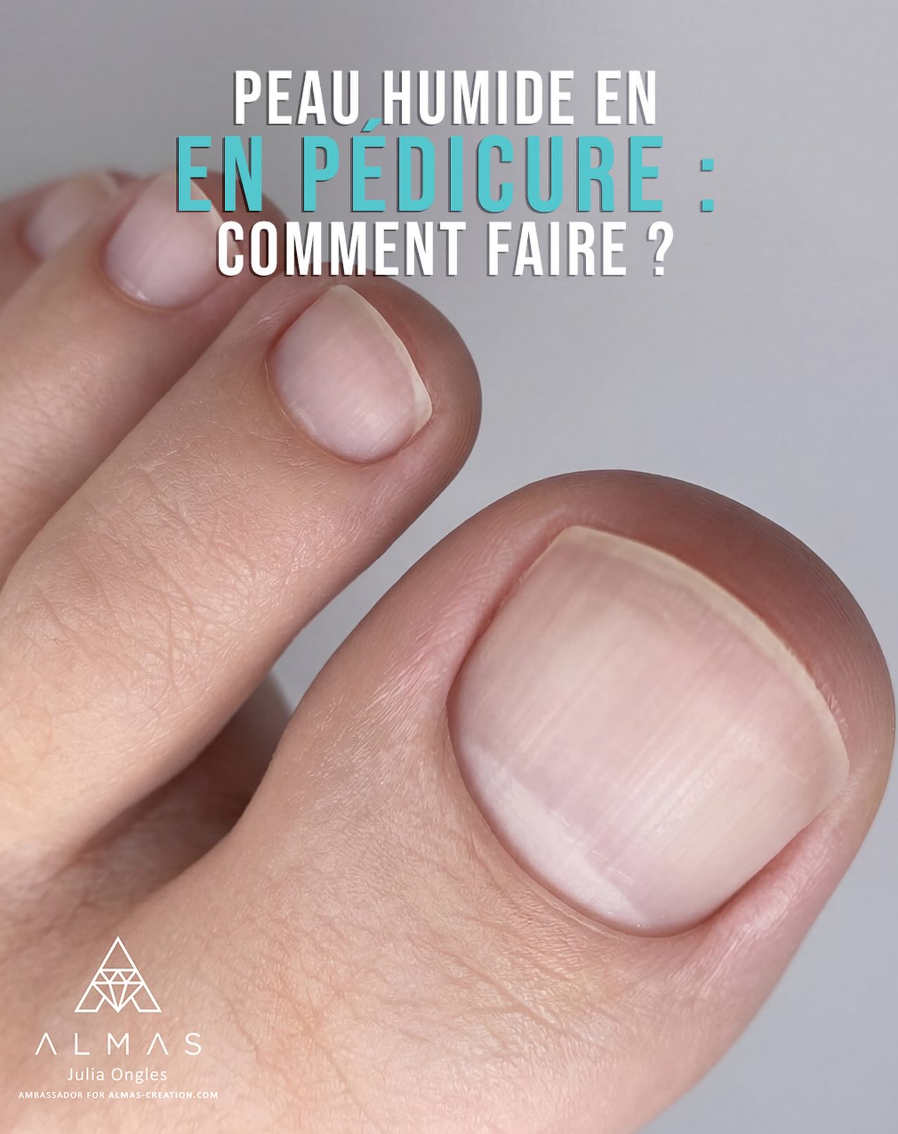 Quand la peau est humide durant une pédicure, le ptérygion devient plus mou et se ramollit rapidement. Beaucoup de techniciens commencent alors à travailler plus longtemps avec leur embout ou à augmenter la vitesse de leur ponceuse! ❌
👇Mais il est important de comprendre une chose : la technique de travail ne change pas. Le ptérygion est déjà ramolli, il est donc plus facile et plus propre à retirer avec un repousse-cuticules ✨
Que faire :
👉 retirer d’abord délicatement le ptérygion,
👉 sécher la peau avec du talc ou un antiseptique alcoolisé,
👉 puis finaliser le travail avec l’embout dédié.
Pourquoi cette méthode est meilleure ? 👇
• les sinus restent plus propres,
• le résultat est plus net,
• il y a moins de risque de traumatiser la peau,
• le travail est plus rapide.
Une pédicure propre, ce n’est pas une question de vitesse, mais de compréhension de la peau et de la technique 🤍
Et vous, comment travaillez-vous avec une peau humide? Si vous avez d’autres astuces à partager, n’hésitez pas! 👀
#pedicure #pédicure #nailsonpoint #onglesmontpellier #onglesparis