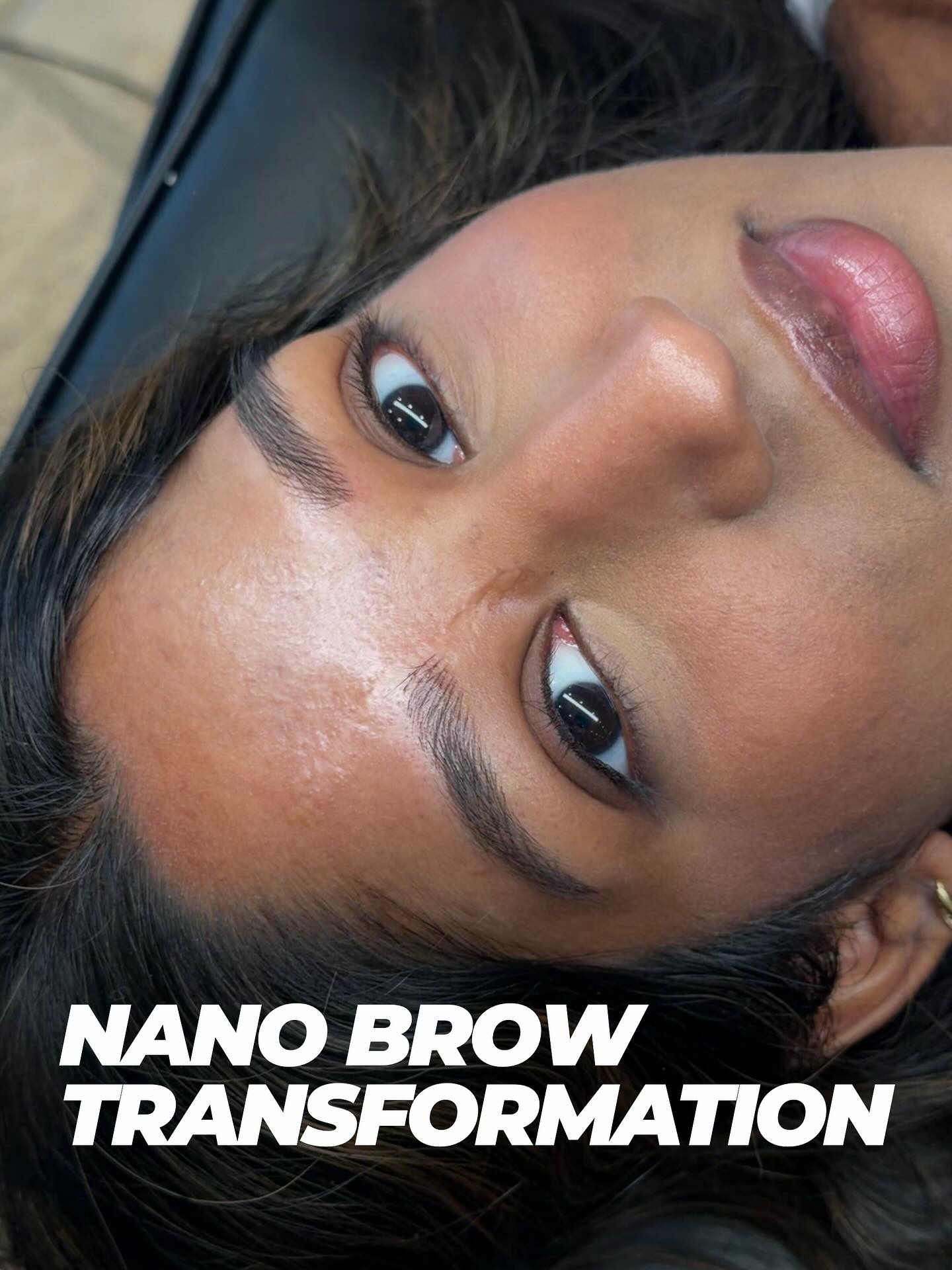 One of our recent beautiful brow transformations !
Nano Machine Hair Strokes
This technique uses a machine to gently implant pigment into the skin, creating soft, pixelated hair-like strokes that mimic the natural appearance of real brow hair.
Machine hair strokes are less traumatic to the skin and allow for a softer, more dimensional healed result. The tiny pixels of pigment blend seamlessly with your natural brow hairs, creating realistic definition without harsh lines.
Perfect for clients looking for natural looking brows that enhance their features while maintaining a soft, effortless appearance.