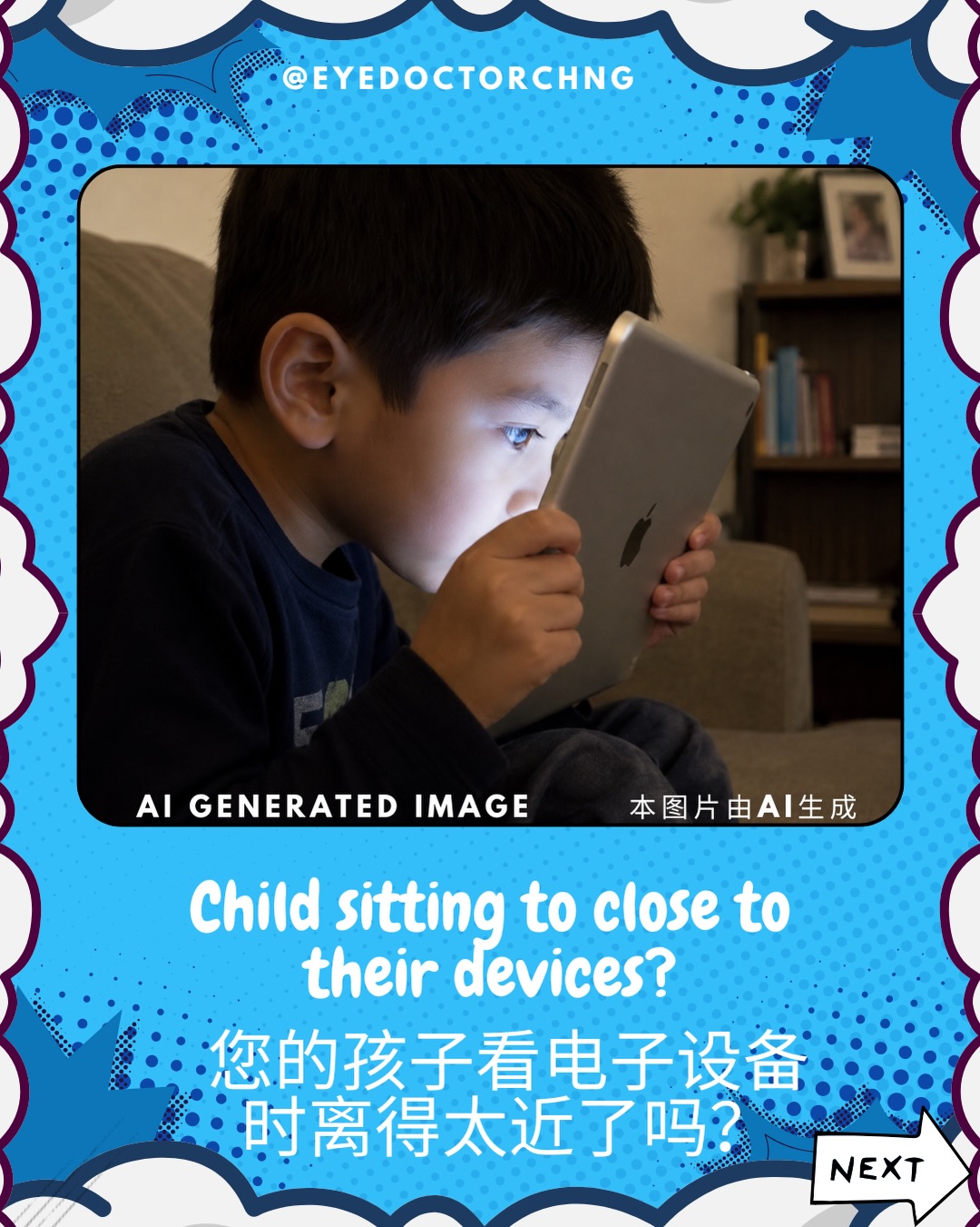 Myopia (short sightedness) is rapidly becoming a global epidemic which is projected to affect 50% of the world’s population by the year 2050. This is primarily due to extended time spent indoors and heavy use of electronic screens. This crisis extends beyond just needing glasses but carries serious long-term health consequences. As the eye elongates to become myopic, the retina stretches and thins. This drastically increases the lifetime risk of irreversible, sight-threatening conditions such as macular degeneration, retinal detachment and glaucoma.
Consider some simple steps as suggested in the Instagram image posted above to slow down or prevent myopia in your child.
近视(短视)正迅速成为全球性的流行病,预计到2050年将影响全球50%的人口。这主要是由于人们长时间待在室内以及过度使用电子屏幕所致。近视带来的危机不仅仅是需要佩戴眼镜,更会导致严重的长期健康后果。随着眼球增长变长而形成近视,视网膜会被拉伸并变薄,从而显著增加终生罹患不可逆、威胁视力疾病的风险,例如黄斑变性、视网膜脱离和青光眼。
请参考上述Instagram图片中建议的一些简单方法,以减缓或预防孩子发生近视。
#myopia #retinaldetachment #maculardegeneration #glaucoma #eyedoctorchng