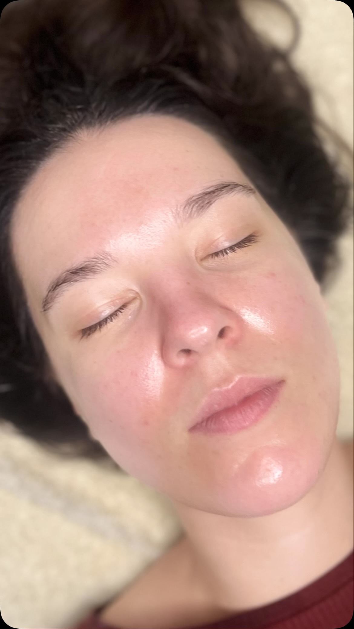 ✨From years of struggling with adult acne to glowing with confidence on her wedding day ✨
This beautiful bride to be began her skin journey 12 months ago, and what’s a transformation it has been 💍
For the past year, we’ve combined targeted in-clinic treatments , including professional peels and microneedling with a carefully tailored homecare routing using powerful acne- focused ingredients from Noon Aesthetic. Alongside this, I’ve use my knowledge and experience in acne management to create a plan that was completely personalised to her.
But achieving clear skin isn’t just about products and treatments .
When working with acne, I take a deeper approach, explore factors such as hormones, diet, gut, health, stress and overall well- being . Skin health is never just skin deep.
If your planning a wedding and want to feel your absolute best in your skin , don’t leave it to last minute . START YOUR JOURNEY NOW ❤️
DM me to book your skin consultation and let’s create a plan tailored just for you
Anna ❤️
@noon_aesthetics.uk
#adultacne #acne transformation #bridetobe #weddingreadyskin leightonbuzzard