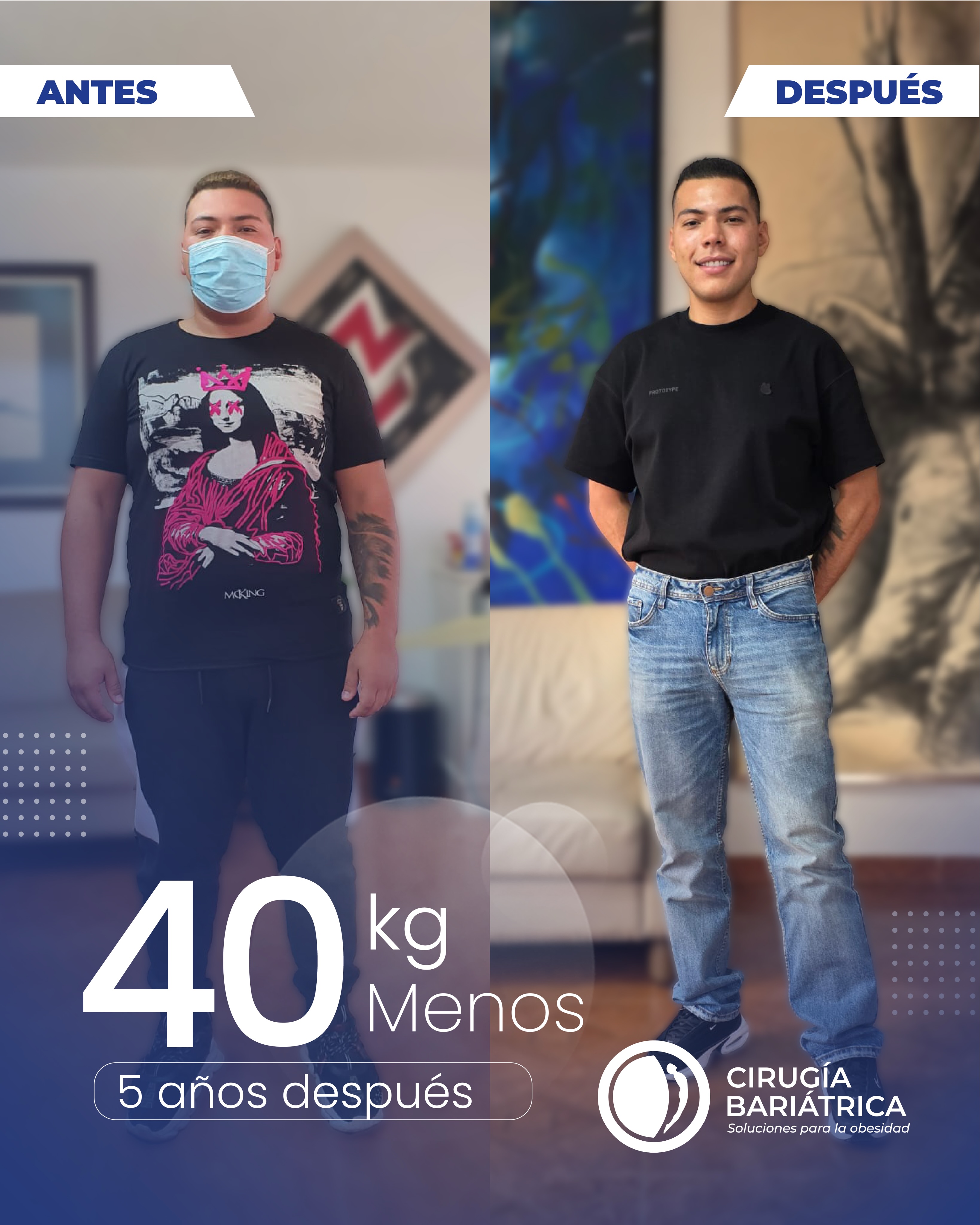 40 kilos hace 5 años de operado y se sostiene… un resultado que trasciende lo estético y refleja una verdadera evolución en salud ✨💯
Gracias a la cirugía bariátrica realizada por el Dr. Eduardo Bolaños y su equipo, el paciente inicia una nueva etapa con mayor bienestar, energía y una notable mejora en su calidad de vida 💪✨
Con el respaldo de tecnología avanzada, experiencia médica y un enfoque integral en el seguimiento, se evidencian resultados reales y sostenibles en el tiempo ✅🏆
📍Agenda tu valoración y comienza tu proceso hacia una mejor salud.
#bariatric #bariatricsurgery #bajardepeso #weightlosssurgery #cirugiabariatrica