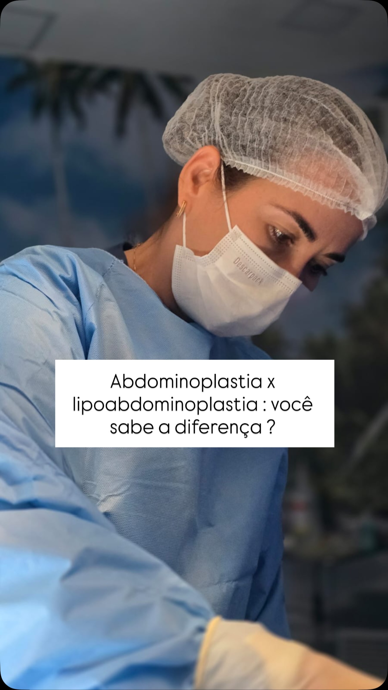 Abdominoplastia x Lipoabdominoplastia: você sabe a diferença?
Muitas pessoas acham que são a mesma cirurgia, mas existem diferenças importantes.
✅ Abdominoplastia
É indicada principalmente para quem tem excesso de pele, flacidez abdominal e afastamento dos músculos (diástase). O foco é retirar a pele excedente e reconstruir a parede abdominal, proporcionando um abdome mais firme e plano.
✅ Lipoabdominoplastia
Associa a abdominoplastia à lipoaspiração. Além de retirar o excesso de pele e corrigir a flacidez, permite esculpir melhor a cintura, o abdome e os contornos corporais, proporcionando um resultado mais harmonioso e definido.
De forma simples:
• Abdominoplastia → trata principalmente a flacidez e o excesso de pele.
• Lipoabdominoplastia → trata a flacidez, o excesso de pele e também a gordura localizada, melhorando o contorno corporal.
A melhor técnica depende das características de cada paciente e deve ser definida após uma avaliação individualizada.
✨ O mais importante não é escolher a cirurgia mais moderna, mas sim a que oferece o melhor resultado e a maior segurança para o seu caso.