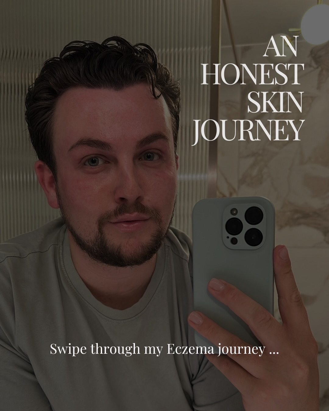 An honest moment 🤍
4 weeks ago, I had a HUGE eczema flare up across both cheeks and my forehead.
To some, it might not seem like a big deal, but for me it was. As someone who works within the skin and beauty industry, I take pride in looking after my skin, so seeing it react the way it did really knocked my confidence 😔
After trying multiple lotions and potions at home, and taking some advice from a dear friend (who truly is a skin guru @carolinecorderoythemews ), I knew I needed to strip everything back and return to the basics.
I reintroduced a range I use and trust within the salon — Aquatherm by @skeyndor.uk & paired it with regular Blue Light LED Therapy.
Over the last 4 weeks, I’ve managed to calm the flare up, reduce inflammation and redness and most importantly, restore my skin barrier and overall skin health ✨
These photos were taken throughout that journey, with the final image being taken today.
Working in the beauty industry, there’s often an expectation that we should have “perfect” skin all the time. But the reality is that skin is constantly changing, and it’s always a journey.
I wanted to share mine, because behind every skin professional is a real person who experiences skin concerns too 💙
#eczema #skinhealth #skinbarrierrepair #realskin #skeyndor
