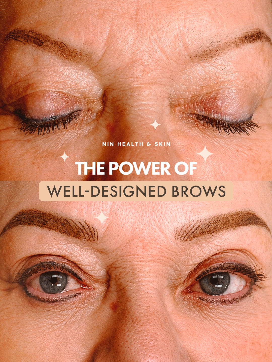 A subtle brow transformation with a powerful impact ✨ Well-designed brows can lift, frame, and refresh the entire face. Natural, elegant, and beautifully defined.
