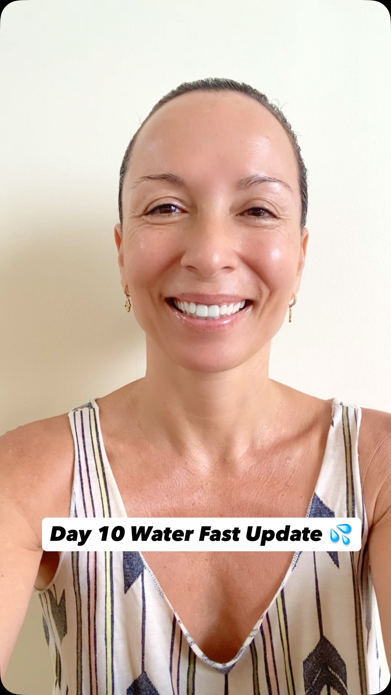 Day 10 Water Fast Update! Now 3 days of re-feeding which is very important.
Refeeding is an essential part of fasting because it shifts the body from a state of cellular cleanup and fat burning into one of repair, rebuilding, and nourishment. After a prolonged fast, carefully reintroducing nutrients helps restore electrolytes, support digestive function, preserve muscle tissue, and provide the building blocks needed for regeneration and recovery. The fast creates the opportunity for renewal; the refeed supplies the materials to make it happen.
#waterfastingjourney
#waterfasting
#autophagy
#cellularnutrition
#epigenetics