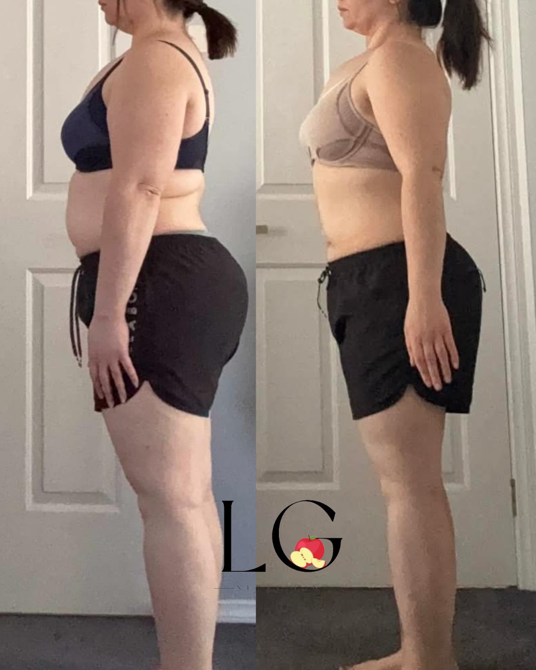 INSANE FAT LOSS RESULTS 🔥
This client is a full-time worker, mum, and one of the hardest-working women I’ve ever met.
In one of the toughest years of her life, she still showed up for herself.
She didn’t need fancy meals or hours in the kitchen.
She needed simple, quick meals, accountability, education, and a plan she could actually stick to.
Recently she sent me this:
“Thank you for teaching me how to have a healthy, balanced relationship with food. In what has been the hardest year of my life, you have been a saviour.”
❤️❤️❤️
If you’ve ever thought:
❌ I’m too busy
❌ I’m a mum, I can’t focus on myself
❌ I’ll start when life settles down
Think again.
My client achieved this through my 1:1 coaching and has never felt more confident in herself.
Comment FATLOSS below to get started 👇
#fatlossresults #weightlossjourney #nutritionist