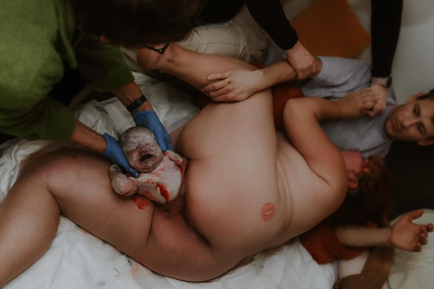 📸: @naomivonkphotography
Let’s talk about pushing.
Because despite what movies have taught us, you are not required to be on your back, holding your breath, while someone counts to ten.
In reality, one of the most effective pushing positions is the one your body naturally settles into.
This mother chose a side-lying position, and there are some real benefits to it:
✨ It can help create more room in the pelvis for baby to rotate and descend.
✨ It allows the birthing parent to rest between contractions.
✨ It can reduce strain and exhaustion during a long pushing stage.
Most importantly?
It reminds us that birth isn’t one-size-fits-all.
There isn’t a “best” position to push your baby out. There is only the position that works best for you in that moment.
Standing.
Squatting.
Hands and knees.
Side-lying.
On the toilet.
In the tub.
Your body is the best guide in the room.
And sometimes that means welcoming your baby while lying quietly on your side, surrounded by people who trust the process.
That’s exactly what strength can look like.
𝐀𝐥𝐰𝐚𝐲𝐬 𝐫𝐞𝐦𝐞𝐦𝐛𝐞𝐫: 𝐁𝐢𝐫𝐭𝐡 𝐦𝐚𝐭𝐭𝐞𝐫𝐬. 𝐒𝐨 𝐝𝐨 𝐲𝐨𝐮. 💚@doula.heather.taylor
#SanDiegoDoula
#SanDiegoBirth
#BirthEducation
#HomeBirthDoula
#PregnantInSanDiego