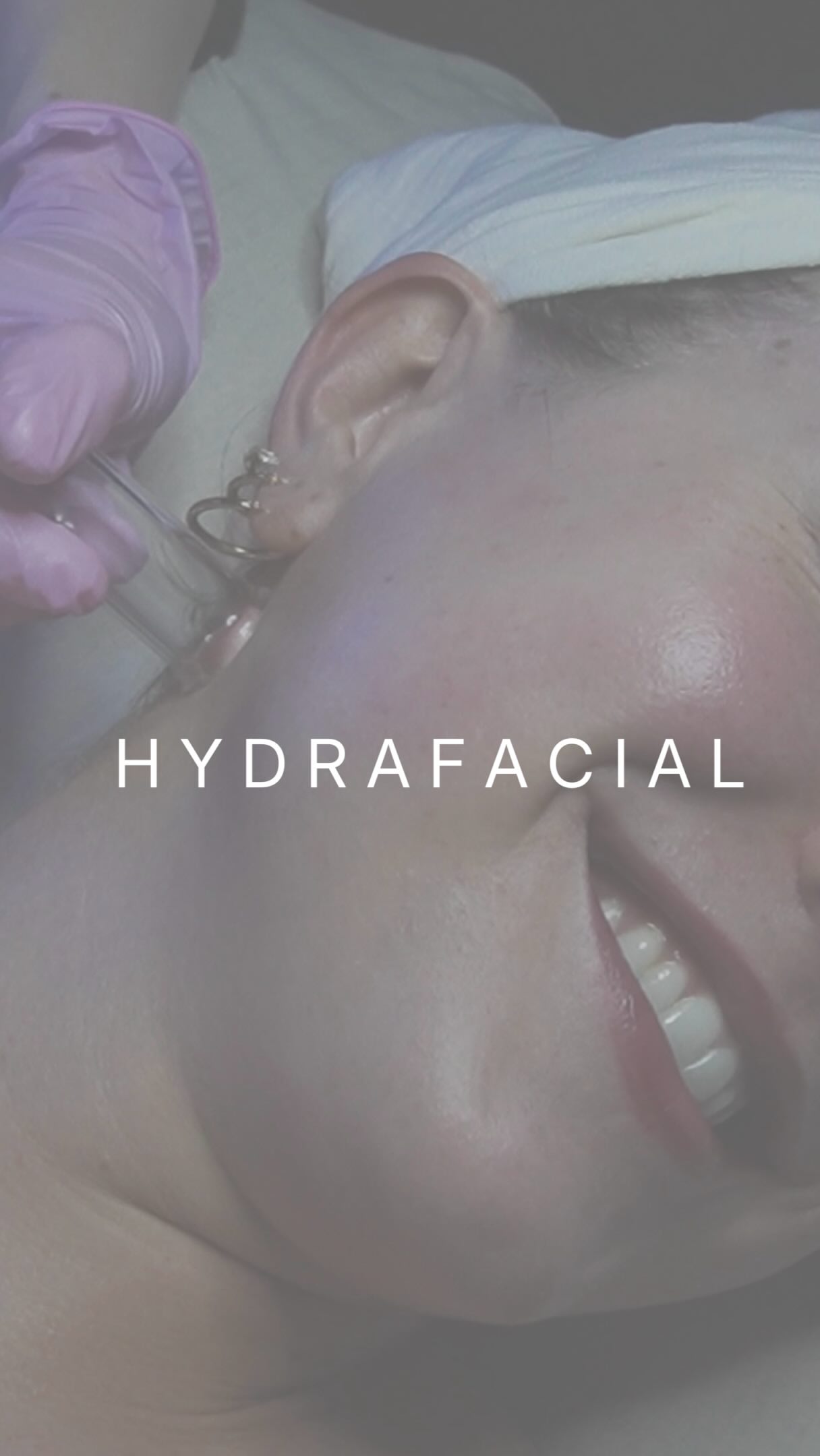 H Y D R A F A C I A L - Extractions, red light therapy, scalp massage, hand massage, and of course the hydrafacial itself.
To start the service a foot soak and an in depth consultation about your skin and your concerns making sure we are using the products your skin needs and answering any questions you might have about the hydrafacial and all of its benefits.
Call or text Gervais to book your appointment 🤍