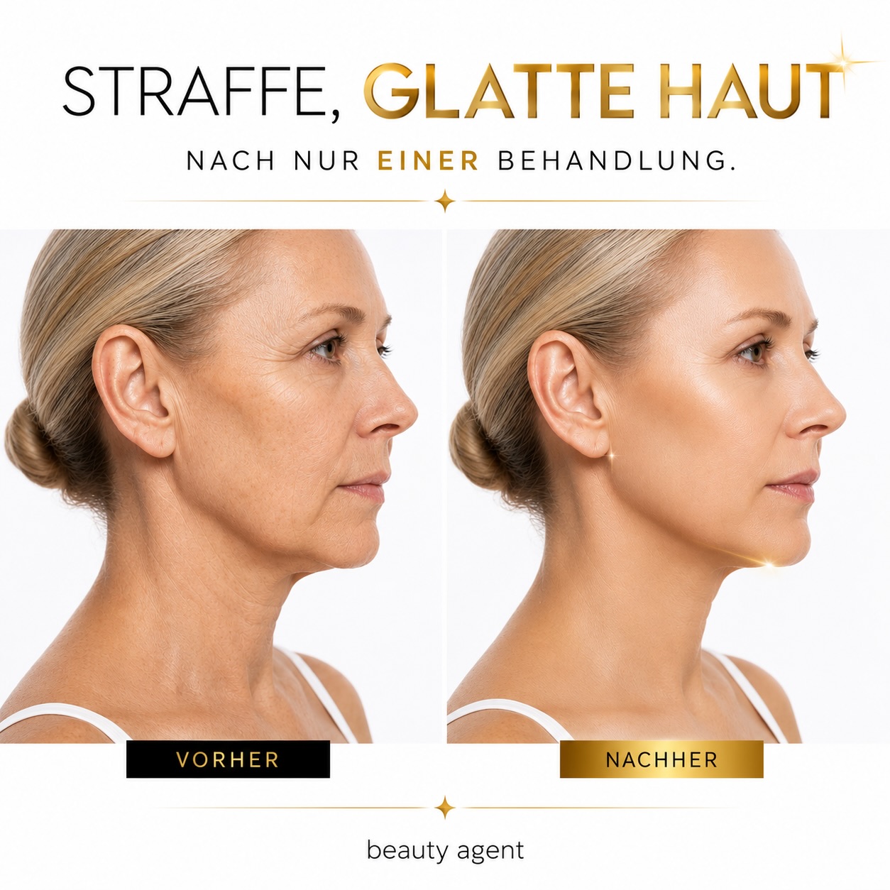 Ich mach dich jünger und stoppe zudem dein Alterungsprozess‼️‼️‼️‼️
#lifting #antiaging #hautstraffung #endolift Verjüngung Jüngeraussehen