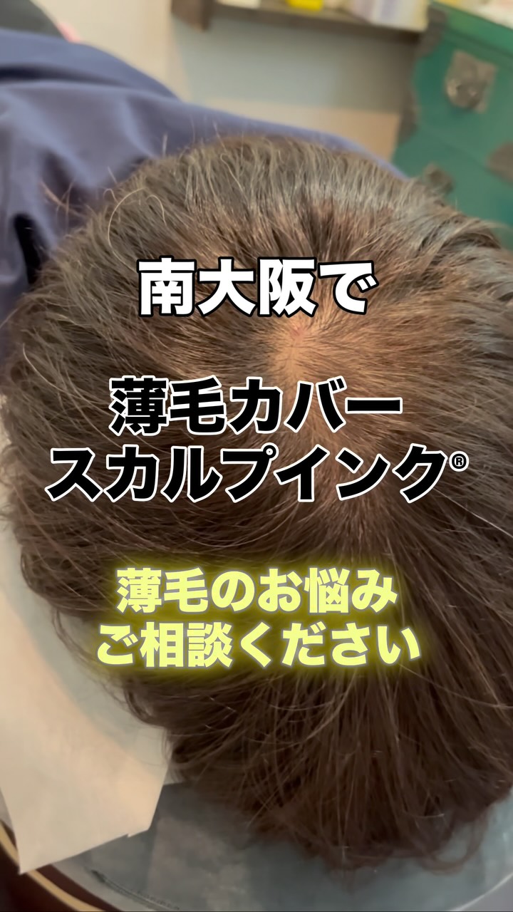 その薄毛、まずは“スカルプインク®“が自分に合うのか、から試しませんか?
当店では、皆様に安心して試していただけますように。初回施術で定着適性を見極め、万が一合わない場合は半額返金保証いたします。
無理に続けさせることはありません。結果に自信があるから、この仕組みです。
👉まずは“あなたに合うか”を確認してください。
【初回適正診断保証(半額返金)】
初回施術後、頭皮状態や色素の定着を確認し、当店基準で継続が難しいと判断した場合、初回施術費用の半額を返金いたします。
※以下の場合は対象外
・当店が継続可能と判断した場合
・お客様都合による中断など
・デザインの好みによる不満など
・アフターケア未実施など
──────────────────────
髪が薄くなると、見た目だけでなく気分まで沈みがち。
でも、もう一人で悩まなくて大丈夫です。
前髪・つむじ・分け目。
どこから見られても怖くない自然な仕上がりへ。
スカルプインク®は極小ドットで濃さを再現する
“最もバレにくい”頭皮タトゥー技術。
・痛みほぼなし/麻酔不要
・色落ちしにくい専用インク
・即日変化を実感/男女対応
産後脱毛・円形脱毛・傷跡にも対応。
──────────────────────
※美容師歴20数年の認定アーティストが責任を持って施術します。
※この地で開業18年となります、ご安心してお任せください。
大阪・和泉市|THREE BRANCHES
✨今なら3.3万発
49500円が33,000円(税込)
今なら何度でも‼️
📩公式LINEでご相談ください。
#スカルプインク
#薄毛対策
#南大阪
#つむじ
#頭皮タトゥー
※大阪で薄毛で悩まれている男性も女性も
ぜひ1度お声掛けください。