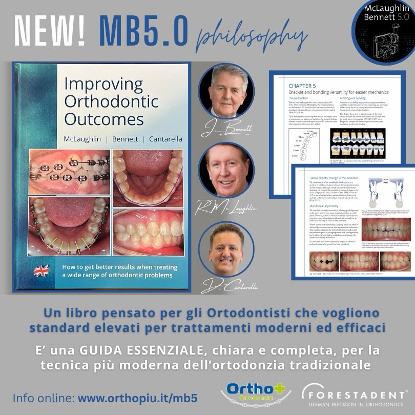📘 Improving Orthodontic Outcomes
di John Bennett, Richard McLaughlin e Daniele Cantarella
Una guida essenziale per gli ortodontisti che desiderano raggiungere standard elevati con trattamenti moderni ed efficaci.
Un testo chiaro e completo per approfondire la filosofia MB 5.0, evoluzione della più moderna ortodonzia tradizionale.
Info:
https://www.orthopiu.it/mb5
#mclaughlin #johnbennett #mb5 #straightwire