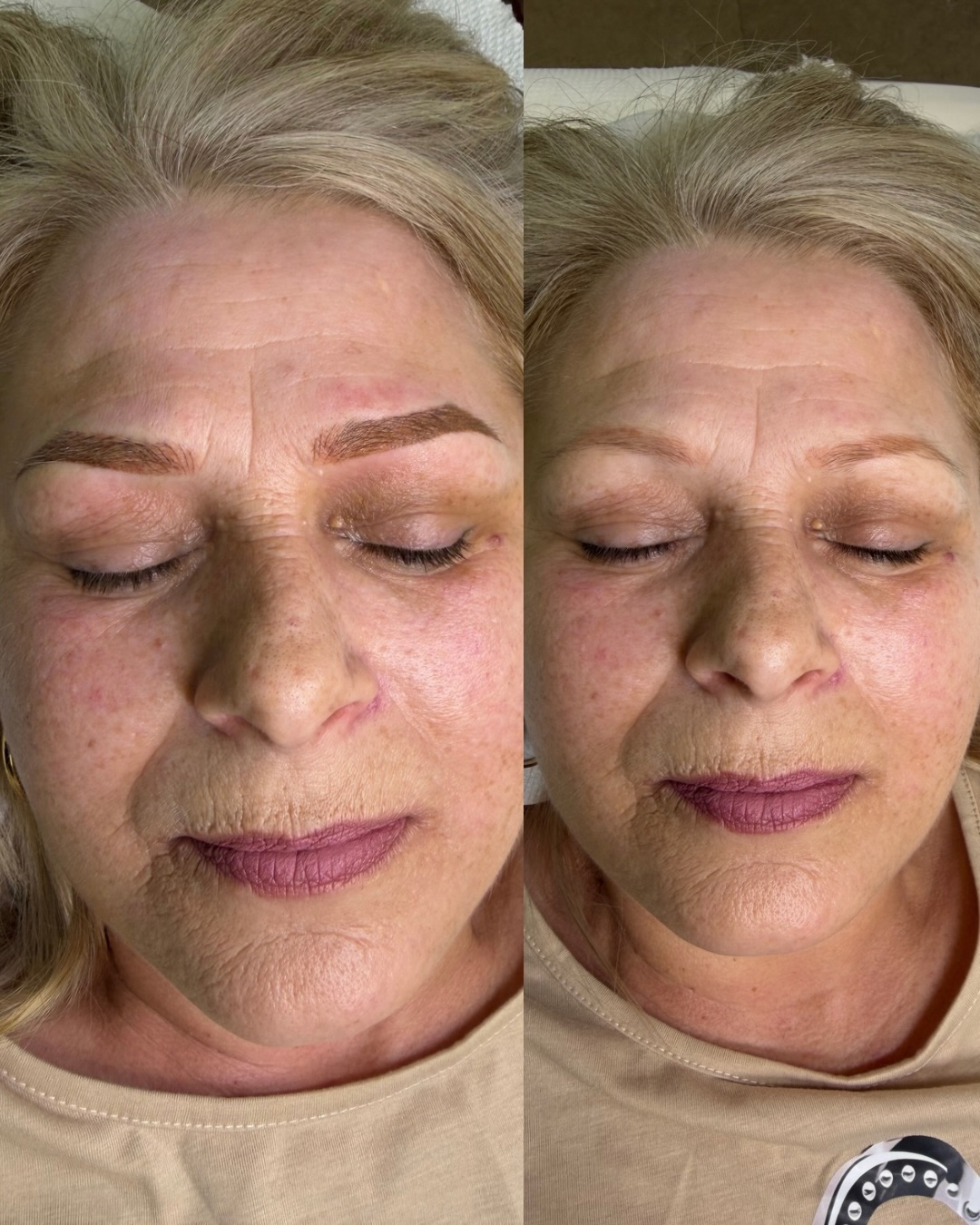 Are you a busy mom, working long hours and tired of filling in your brows every morning?
This transformation combines Microblading + Shading to create a soft, natural, and effortless look. We also corrected an old faded tattoo, restoring beautiful definition without making the brows look overly done. 🫶
Not sure which brow treatment is right for you? Every client is different, and the best technique depends on your skin, existing brow hair, and desired result.✨
Book your consultation and let’s find the perfect option for you. Save this post for inspiration.
www.belenspmustudio.com
info@belenspmustudio.com
#pmu #combinationbrows #combobrows #browscardiff #permanentmakeup