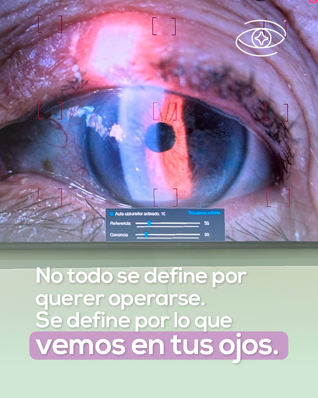 No todo se define por el deseo de operarse, sino por lo que realmente necesita tu visión ✨
Cada ojo tiene una historia distinta, por eso cada decisión debe partir de una valoración adecuada 🩺💜
📲Escribenos por WhatsApp y resuelve todas tus dudas