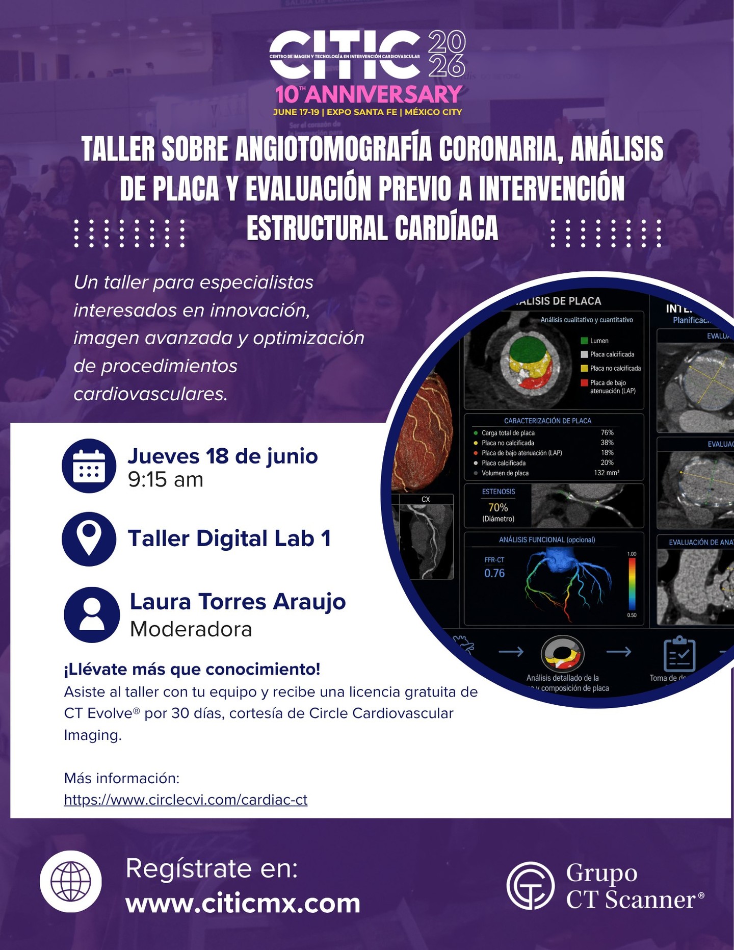 🫀📸 Lleva tu experiencia en imagen cardiovascular al siguiente nivel.
Participa en el Taller sobre Angiotomografía Coronaria, Análisis de Placa y Evaluación Previa a Intervención Estructural Cardíaca, donde conocerás herramientas avanzadas para optimizar la planeación y toma de decisiones en procedimientos cardiovasculares.
✨ Beneficio exclusivo: Si asistes al taller y llevas tu equipo, recibirás una licencia gratuita por 30 días de CT Evolve® de Circle Cardiovascular Imaging para poner en práctica lo aprendido.
📅 18 de junio
🕘 9:15 a.m.
📍 Taller Digital Lab 1
👩⚕️ Moderadora: Laura Torres Araujo
Conoce más sobre CT Evolve®: https://www.circlecvi.com/cardiac-ct
🔗 Regístrate en: www.citicmx.com
#CITIC2026 #CITIC10Aniversario #Cardiología #ImagenCardiovascular #CardiacCT #CTEvolve #CircleCVI #TomografíaCardíaca #AngiotomografíaCoronaria #IntervencionismoCardiovascular #CardiologíaIntervencionista #EducaciónMédica #InnovaciónMédica #CardioImaging #MedicalEducation #HeartTeam #Cardiology #CardiovascularImaging #MéxicoMédico #ExpoSantaFeMexicoCity