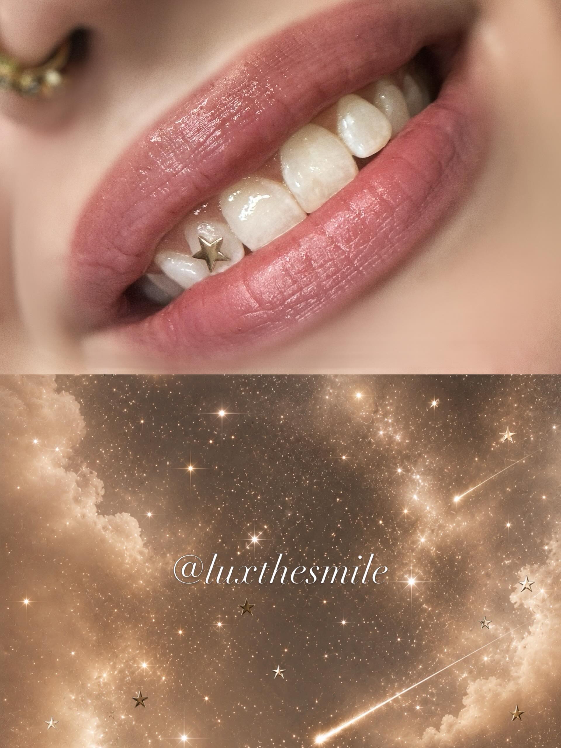 Caught a shooting star… so I put it on my tooth ✨⭐️
#toothgems #napervilleil #chicagotoothgems #explorepage #dreamyvibes