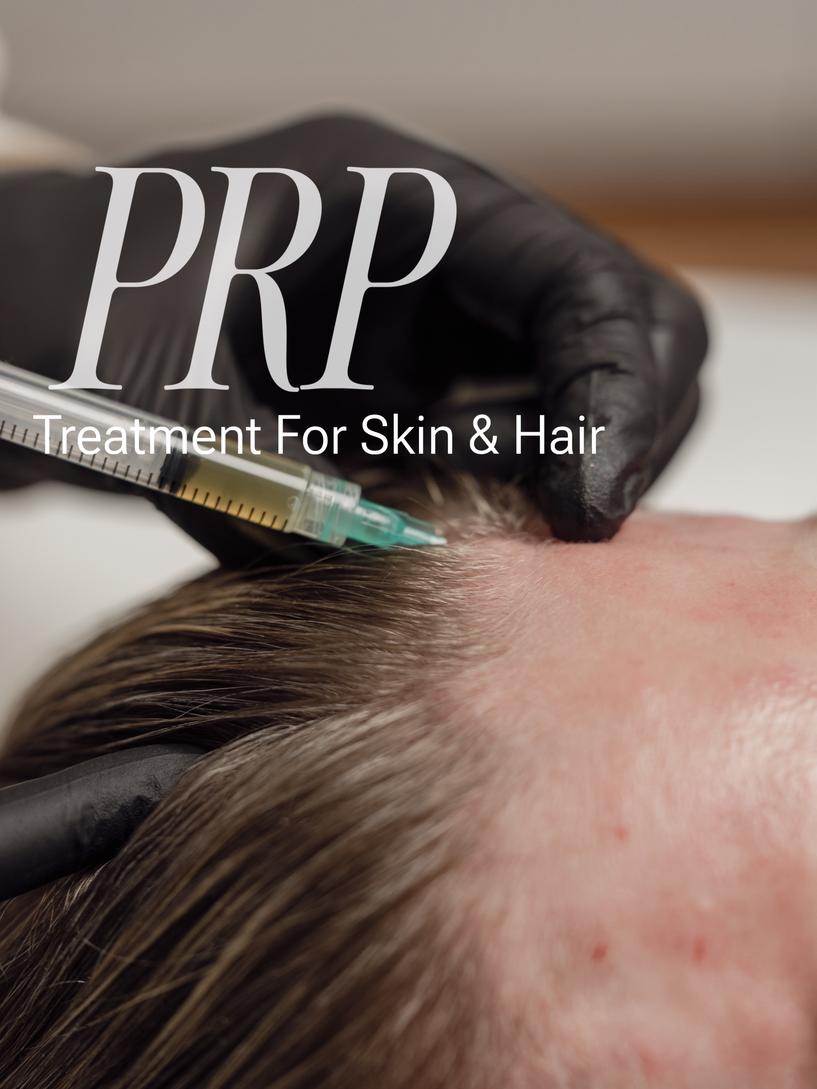 PRP Treatment for Skin & Hair
•Removes deep wrinkles & dark rings
•Removes acne scars & stretch marks
•Overall skin rejuvenation
•Effective against hair loss
-
PRP-Behandlung für Haut und Haar
•Beseitigt tiefe Falten und Augenringe
•Beseitigt Aknenarben und Dehnungsstreifen
•Allgemeine Hautverjüngung
•Wirksam gegen Haarausfall
