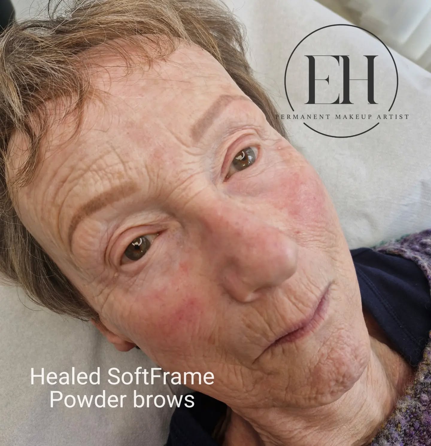 When my lovely client first came to me, she had virtually no brow hair at all and was drawing her brows on every single day.
As her eyesight wasn't as good as it once was, creating the same shape and symmetry each morning had become increasingly difficult and frustrating.
At her appointment, she told me that having her brows done had been life-changing. No more struggling with brow pencils, no more worrying if they matched, and no more spending precious time trying to create brows from scratch every day.
Now she wakes up with beautifully defined, soft-looking brows that frame her face naturally and give her confidence from the moment she starts her day.
This is why I love creating natural powder brows. They don't have to look heavy or obvious to make a huge difference. For clients with little to no natural brow hair, they can restore shape, definition, and confidence while making everyday life so much easier.
✨ Fully healed powder brows ✨ Suitable for little or no brow hair ✨ Soft, natural-looking results ✨ Wake up with your brows already done
#PowderBrows #PermanentMakeupBrows #NaturalPowderBrows #StAlbansPermanentMakeup #ehpermanentmakeup