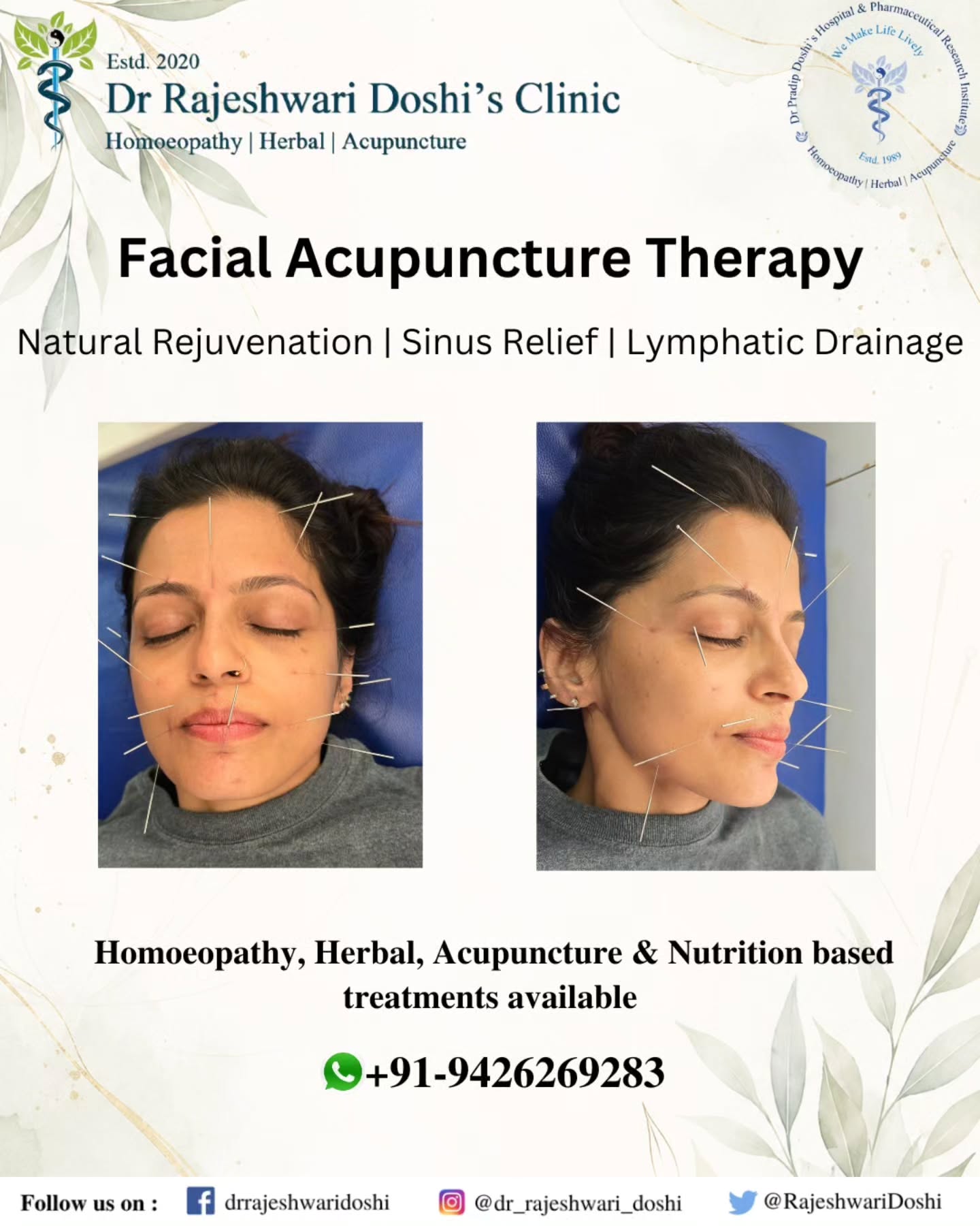 ✨ Facial Acupuncture Session ✨
Today was all about supporting natural healing from within. 🌿
Facial acupuncture is much more than a cosmetic treatment. By stimulating specific acupuncture points, it may help support:
✔ Lymphatic drainage and reduction of facial puffiness
✔ Healthy sinus drainage and relief from sinus congestion
✔ Improved circulation and oxygen delivery to the skin
✔ Relaxation of facial tension and jaw tightness
✔ Support for collagen production and skin vitality
✔ Improved skin texture and natural glow
✔ A firmer, more toned appearance of the skin
✔ Softening of fine lines and wrinkles over time
✔ Overall facial rejuvenation without invasive procedures
Many people are surprised to learn that facial acupuncture focuses not only on appearance but also on addressing underlying imbalances that can contribute to puffiness, congestion, dull skin, and facial tension.
When circulation improves and lymphatic flow is supported, the face often appears brighter, healthier, and more refreshed. Combined with stress reduction and improved relaxation, facial acupuncture offers a holistic approach to both wellness and skin health.
A calm mind, healthy circulation, better drainage, and radiant skin — healing and beauty working together naturally. ✨
#FacialAcupuncture #CosmeticAcupuncture #FacialRejuvenation #NaturalGlow #SkinHealth HealthySkin AntiAgingNaturally WrinkleReduction SkinTightening CollagenSupport LymphaticDrainage SinusRelief SinusitisSupport AcupunctureWorks NaturalHealing HolisticHealth IntegrativeMedicine WellnessJourney AcupunctureTherapy MindBodyBalance