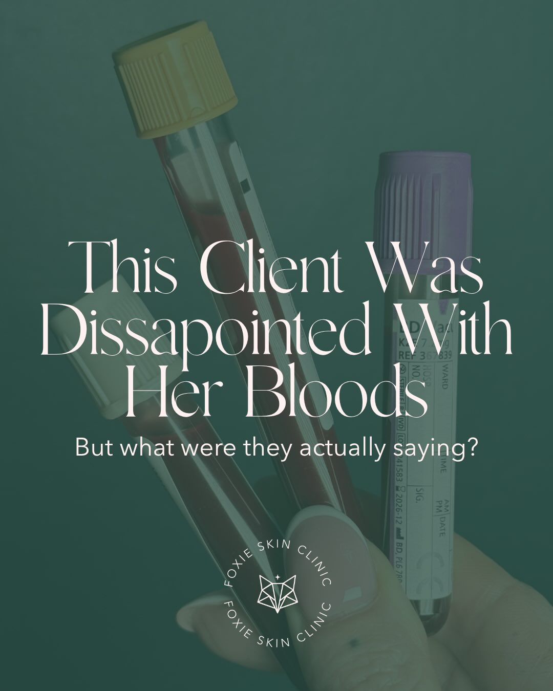 “Your blood tests are normal”
That’s what so many clients are told after visiting their GP 👨🏻⚕️
And yet this client was dealing with persistent acne, missing periods and constant fatigue, but when we looked deeper, her androgen levels were completely normal. No high testosterone. No obvious signs of PCOS as she suspected.
But we did find clues that her body was under stress 😓
Acne isn’t always caused by having too much.
Sometimes it’s caused by not enough.
🔥 Not enough fuel.
🍓 Not enough nutrients.
💤 Not enough rest.
🫶🏼 Not enough support.
Your body doesn’t prioritise clear skin, it prioritises survival.
And when the body perceives stress, inflammation or a lack of resources, healing often gets pushed down the list ⬇️
This is exactly why “everything is normal” shouldn’t be the end of the conversation 📝
If you’ve been told your blood tests are fine, but your skin and your symptoms are telling you otherwise, please know you’re not imagining it. Sometimes we simply need to ask different questions 🫶🏼✨
If you’re ready to be listened to, and start understanding what’s going on inside, DM me the word “BLUEPRINT” for more information on how I can help you 🤍
