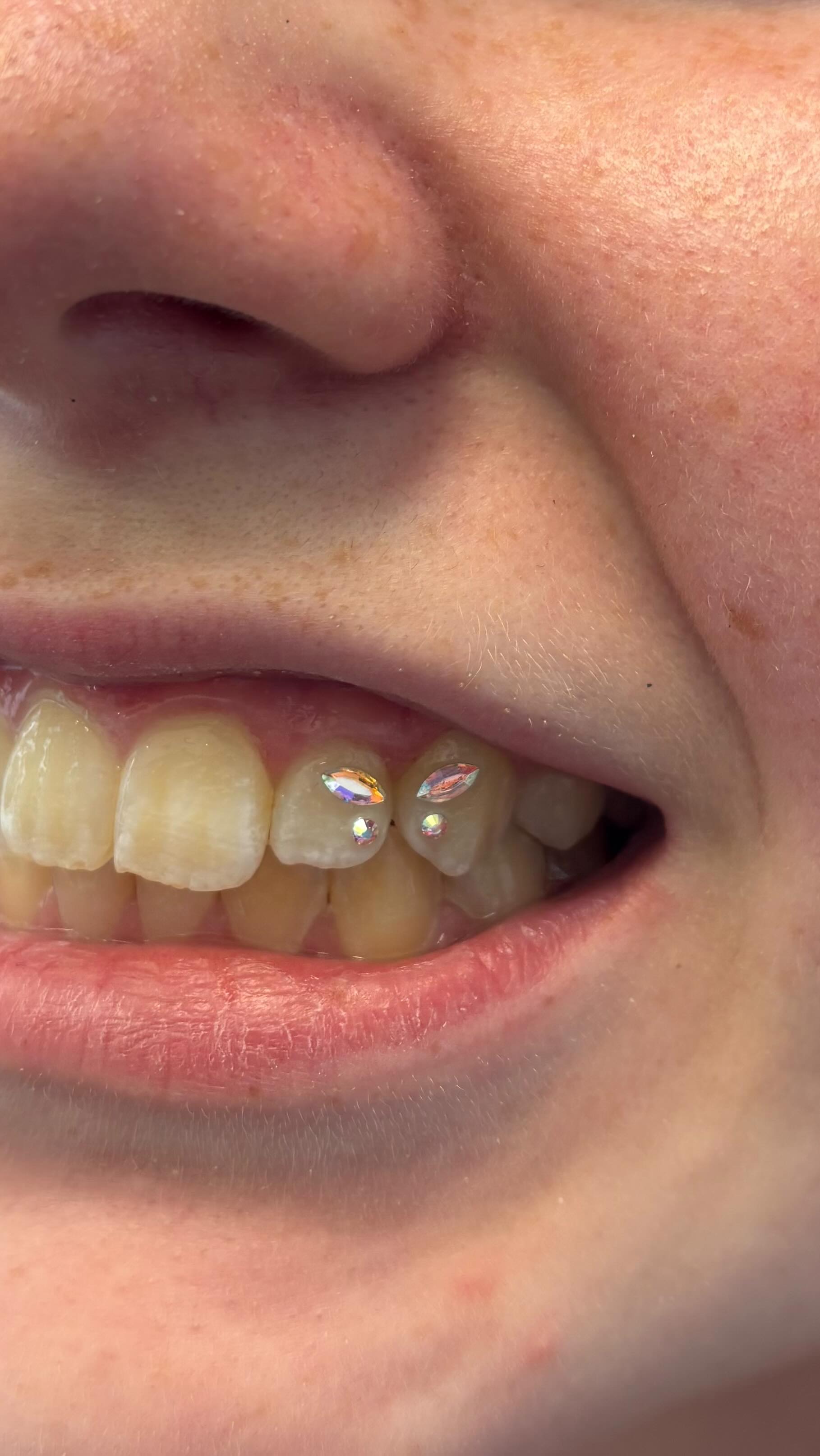 Let’s do a butterfly Tooth gem design by @pleaseinsertpiercing
To book just click the link in bio babes 😘✌️
#toothgem #toothgemtechnician #toothgemz #tattoostudio #london