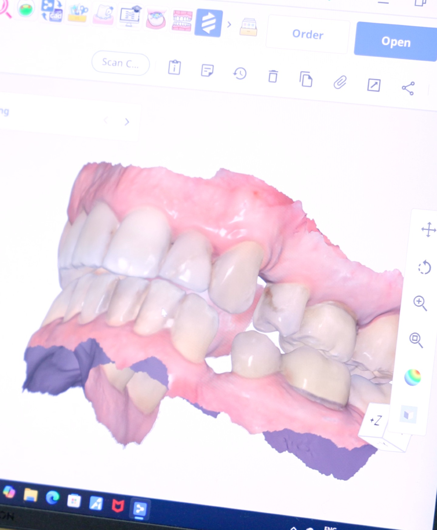 Every treatment plan at The London Centre for Prosthodontics is carefully tailored to the individual patient.
Using advanced digital scanning technology, we are able to assess function, aesthetics and long-term oral health with exceptional precision, helping us create truly bespoke treatment plans designed around each patient’s needs.
Digital dentistry allows for a more comfortable experience, detailed planning and highly predictable outcomes.
Get in touch with our team to book your appointment - we look forward to seeing you soon!
The London Centre For Prosthodontics
29 Weymouth Street
London, W1G 7DB
020 7637 4518
info@londonprosthodontics.com
Monday - Friday: 7:30am - 4:30pm
#SmileMakeover #EmergencyDentistLondon #LondonDentalClinic #SmileTransformation #CosmeticDentistLondon