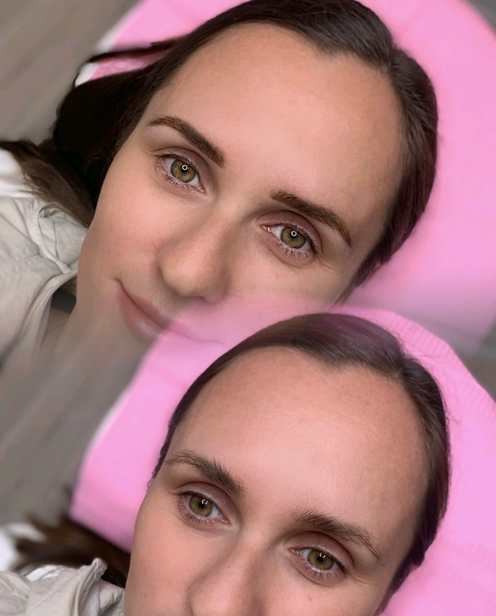 Almost a year ago, a client came to me for a consultation. She had old permanent makeup that had been done many years earlier. As I always do, I recommended what I believed was the best option for her—not the quickest one.
The pigment was very dark, and the shape no longer complemented her features, so I referred her for laser removal before considering any new work.
Today, she came back to see me with clean brows and a fresh canvas. But this time, instead of choosing another permanent procedure, she chose a temporary enhancement: brow shaping and tinting.
Moments like this truly warm my heart. Knowing that a client trusts my advice, follows the process, and then returns to me months later means so much. It’s not just about beautiful brows—it’s about building trust and long-term relationships.
Loyalty is everything, and I am so grateful for clients who place their confidence in me.