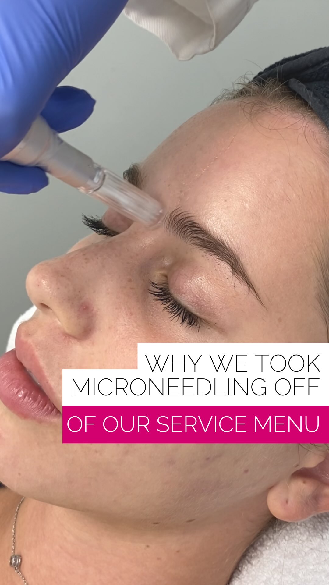 We took microneedling off our service menu… shocking, right? 👀
Who would ever remove the tried, tested, collagen-inducing treatment loved for being safe for all skin types with low downtime?
Well, we did — because we found a way to make it even better.
Meet the Skin Refresher: our glow-boosting maintenance treatment that combines the collagen-stimulating benefits of superficial microneedling with Dermalinfusion to exfoliate, extract, and prep the skin for better absorption of ZO® advanced medical-grade serums.
The result? Smoother texture, refined pores, deeper hydration, brighter skin, enhanced luminosity, and that healthy Skin Worthy glow — with minimal downtime. ✨
Available now, or find it included in our SW Beauty Club.
Book your Skin Refresher today.