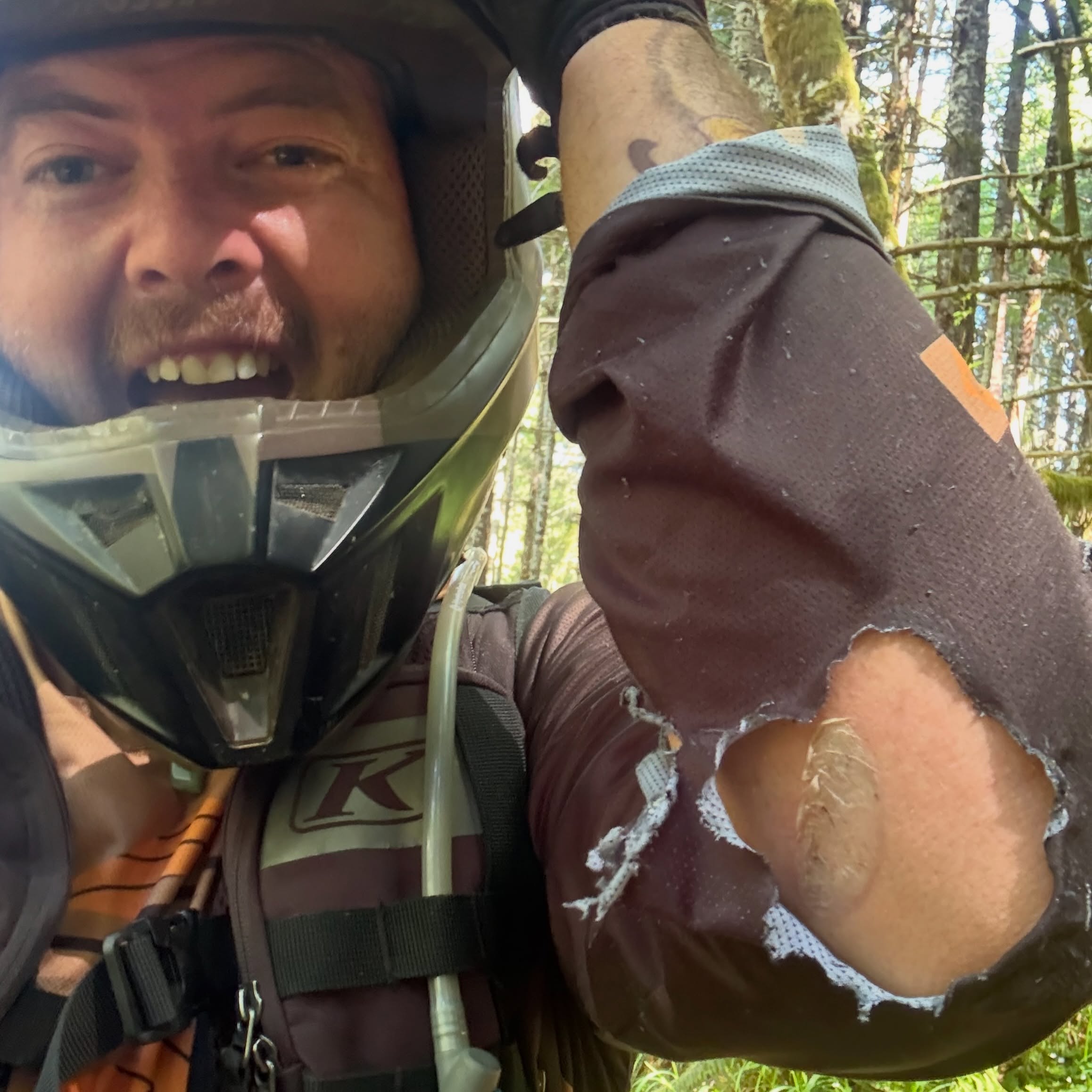 Mmm love me the smell of smoked meat! 🍖 The only time I ever get hurt on a dirtbike is from the dang 4 stroke headers..just brushing one sizzles on a scar for years!
Got one on my elbow, top of foot, my tramp stamp area and my inner thigh! No other dirtbike injuries yet