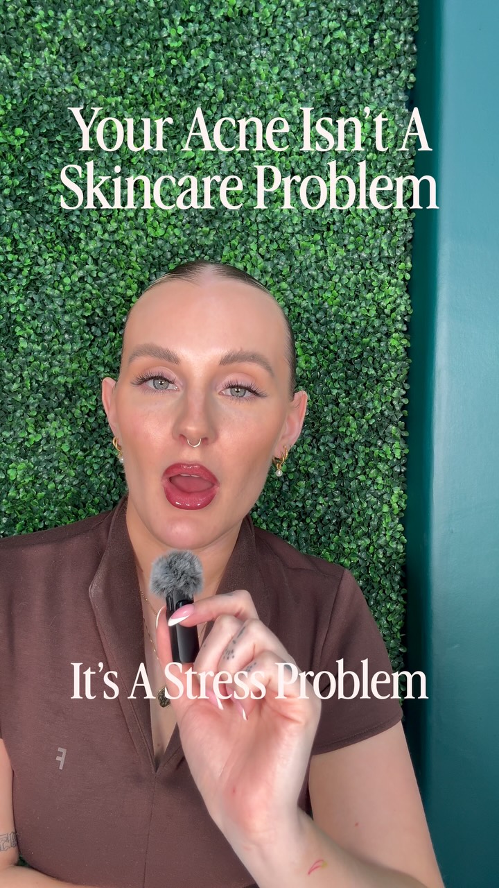 It’s the chronic stress girl, not the cleanser 👀
You can have the cleanest routine in the world, double cleansing, serums, the lot, and still be breaking out every single month because nobody has addressed what’s actually driving it.
Here’s what’s happening underneath the surface ⬇️
When you’re stressed, your body releases cortisol. Cortisol spikes insulin. And insulin spikes sebum production, sending your oil glands into overdrive and creating the perfect environment for breakouts to thrive 🦠
So whilst you’re out here switching cleansers and testing every new serum that lands in your feed, the real trigger is sitting in your nervous system, completely untouched 🫠
This is exactly why I built The Acne Blueprint 📖
It’s a 12 week, 1-1 online programme that goes beyond topical fixes to look at what’s really going on inside your body, through functional blood testing, a bespoke plan built around your bodies needs, weekly check ins to keep you accountable and adjust as we go 🫶🏼
We’re not guessing ⁉️
We’re testing, tracking and treating the root cause 🙌🏼
This is for you if you’ve been doing everything right and still can’t work out why your skin won’t settle 😓
If you’ve cancelled plans because you didn’t want to be seen in fear of people judging your skin 👀
If you’ve sat in front of the mirror picking apart every new spot, wondering what you did wrong this time 😥
If you’ve spent money on products that promised the world and delivered nothing 💰
Because the problem was never sitting on your skin, it was sitting in your stress levels, your blood sugar, your hormones 🩸
If you’re exhausted from managing it alone and ready for someone to actually get to the bottom of it with you, this is for you.
If this sounds like what you need to finally get the confidence you deserve, DM me the word “discovery” and we can book you a FREE discovery call to see how I can help you 🤍