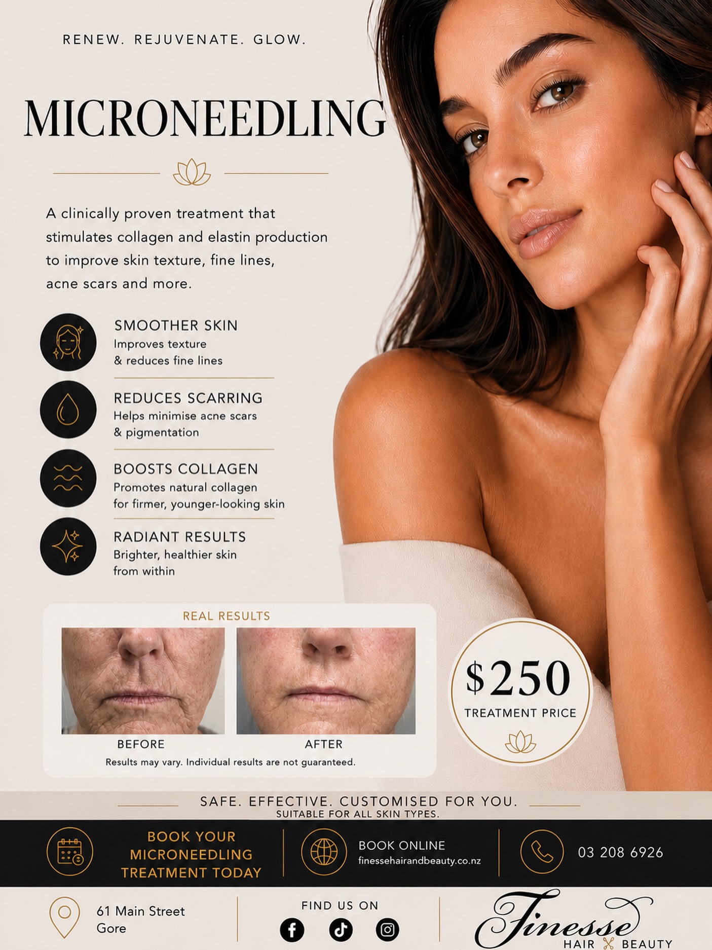 Did you know we offer microneedling!?
✨ Ready to reveal your best skin? ✨
Microneedling is one of the most effective treatments for improving skin texture, reducing fine lines, softening acne scarring, and boosting collagen production for a radiant glow. 🌿
Your skin deserves the investment. Results speak for themselves!
Afterpay & Zip are available
☎️ 03 2086926
https://www.finessehairandbeauty.co.nz