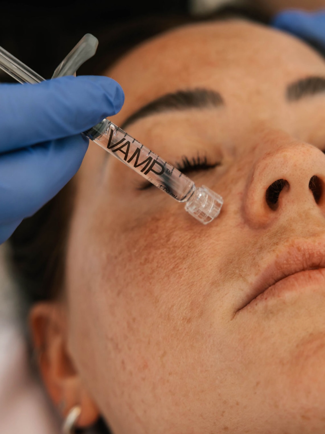 Your skin’s ultimate power duo: VAMP + Microneedling
Microneedling creates thousands of micro-channels in the skin and what you apply immediately after matters *everything*. That’s where VAMP comes in, driving actives deeper than any topical alone.
Here’s what’s working for you 👇
Vitamin A - Accelerates cellular turnover and stimulates collagen synthesis, delivered straight into the skin through open micro-channels for maximum impact.
Multi-Peptides - Act as messengers signalling your skin to produce collagen and elastin, amplifying microneedling’s natural repair response.
Hyaluronic Acid - Floods channels with deep hydration, plumping from within and supporting barrier recovery post-treatment.
Niacinamide - Calms redness, strengthens the barrier, and fades pigmentation while your skin is in active repair mode.
Antioxidants - Neutralize free radical damage and protect the fresh collagen being laid down. 🔬
The perfect pair for real, lasting results
🌐 Book online at viewlaser.com
📧 reception@viewlaser.com