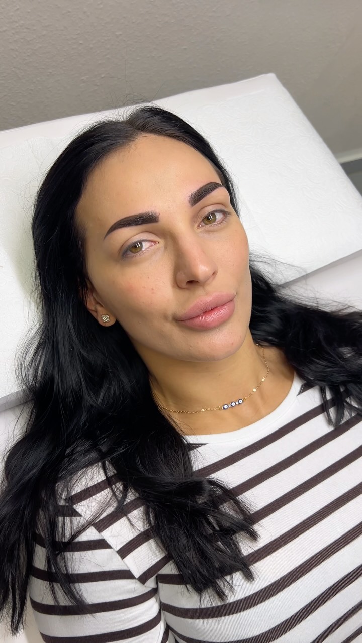 Nicht jedes Permanent Make-up lässt sich retten.
Viele denken: “Das kann man doch einfach darüber pigmentieren.”
Leider ist das nicht immer so.
Wenn ein Permanent Make-up stark asymmetrisch ist, mehrfach überarbeitet wurde oder die Form komplett außerhalb der natürlichen Augenbraue liegt, gibt es Grenzen.
In manchen Fällen empfehle ich zuerst eine Laserentfernung oder eine Aufhellung, bevor ich neu pigmentiere.
Denn mein Anspruch ist nicht, irgendetwas zu überdecken – sondern ein Ergebnis zu schaffen, mit dem du langfristig glücklich bist.
Hast du bereits ein älteres Permanent Make-up und bist unsicher, ob eine Korrektur möglich ist? Schick mir gerne ein Foto – ich sage dir ehrlich, welche Möglichkeiten es gibt.
#brows #permanentmakeup #salzburg