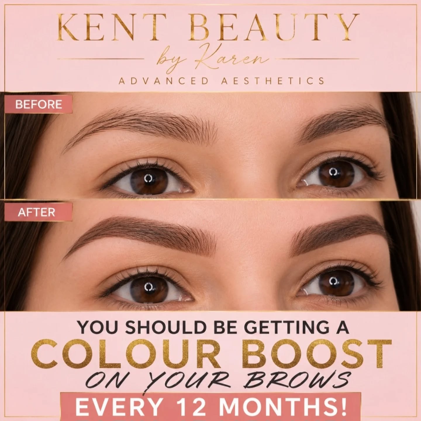 ✨ Over 12 months?!! Time for your Colour Boost? ✨
To keep your Ombre Powder Brows looking fresh and defined, a colour boost is recommended every 12 months.
Waiting until they've almost completely faded (18–24 months+) can mean they no longer qualify for a simple colour boost and may require a full new treatment instead.
Keep them looking beautiful by maintaining them annually. Your brows deserve it! 🤍
Book direct with me now 💉💉
#PowderBrows #ombrebrows #spmuartist #spmubrows kent broadstairs