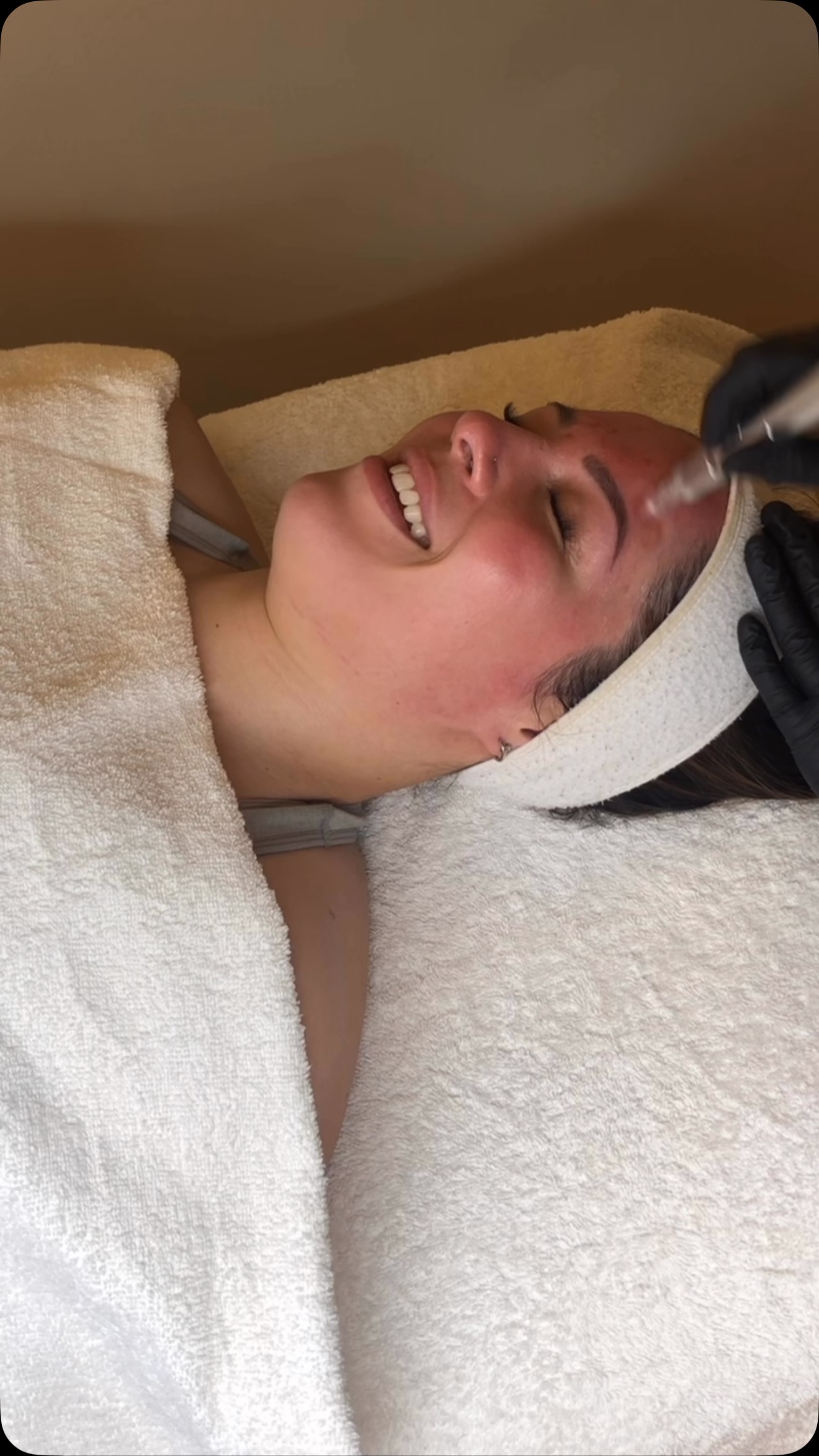 Skin needling is one of those treatments that can genuinely change how someone feels in their skin 💫
Pigmentation, acne, scarring, premature ageing, rough texture… when used intentionally, skin needling is one of the most powerful treatments for creating stronger, healthier, more refined skin over time.
Real skin change, with the right plan behind it 🤍
Winter Collagen Boost is live -Dm me for more information or link in bio 🤗
#skinneedlingmelbourne #collageninductiontherapy #melbournepigmentationtreatment #skintreatment