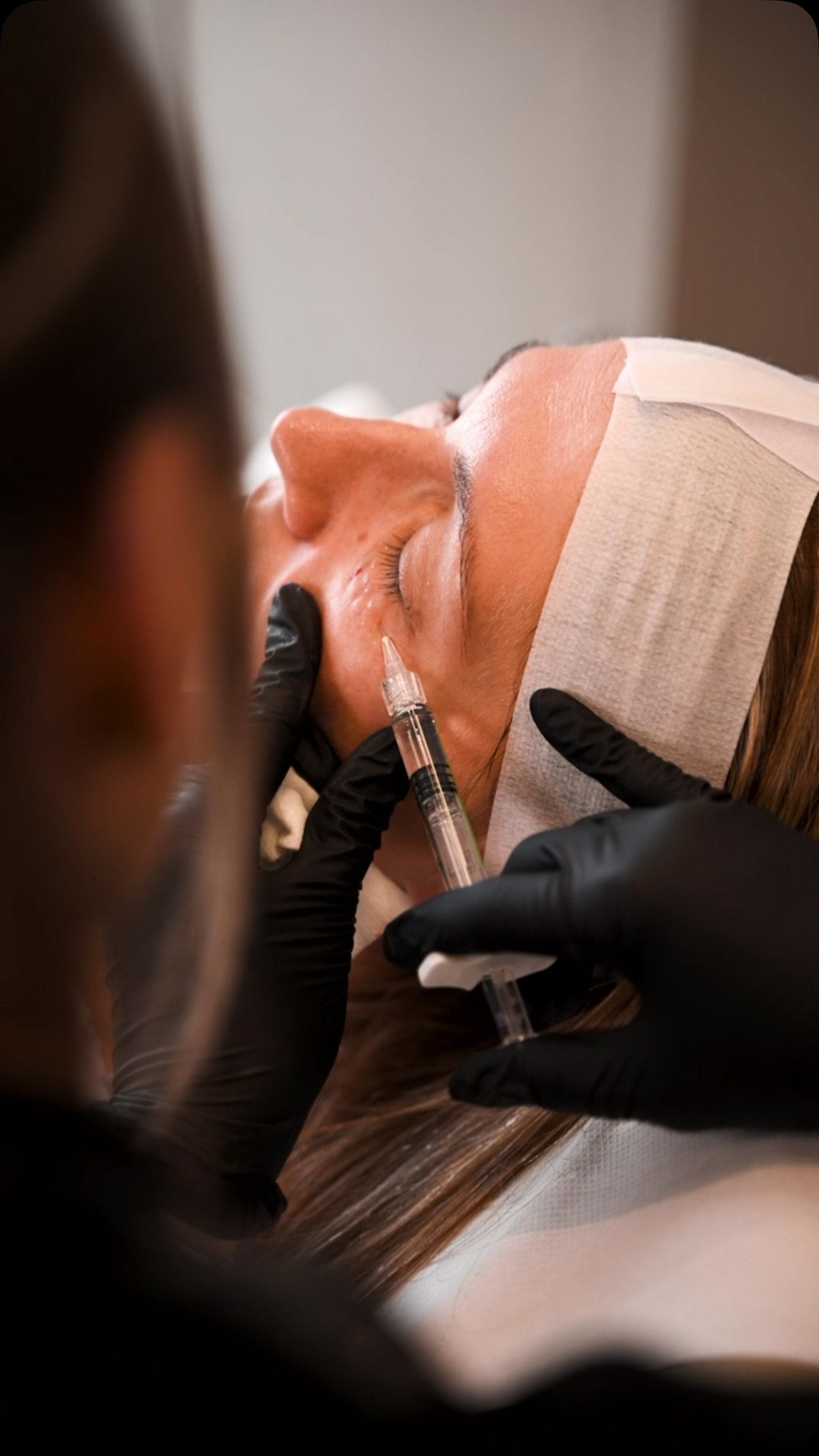 POV: You finally found a treatment for tired-looking eyes. ✨👀
Polynucleotides are all about improving skin quality from within, helping to soften fine lines, boost hydration and refresh the delicate under-eye area for a naturally brighter, well-rested look.
Small changes. Beautiful results. 🤍
Available with all Glow Medspa practitioners. Book your consultation to find out if polynucleotides are right for you.
#Polynucleotides #UnderEyeTreatment #SkinRejuvenation #GlowMedspa #NaturalResults
