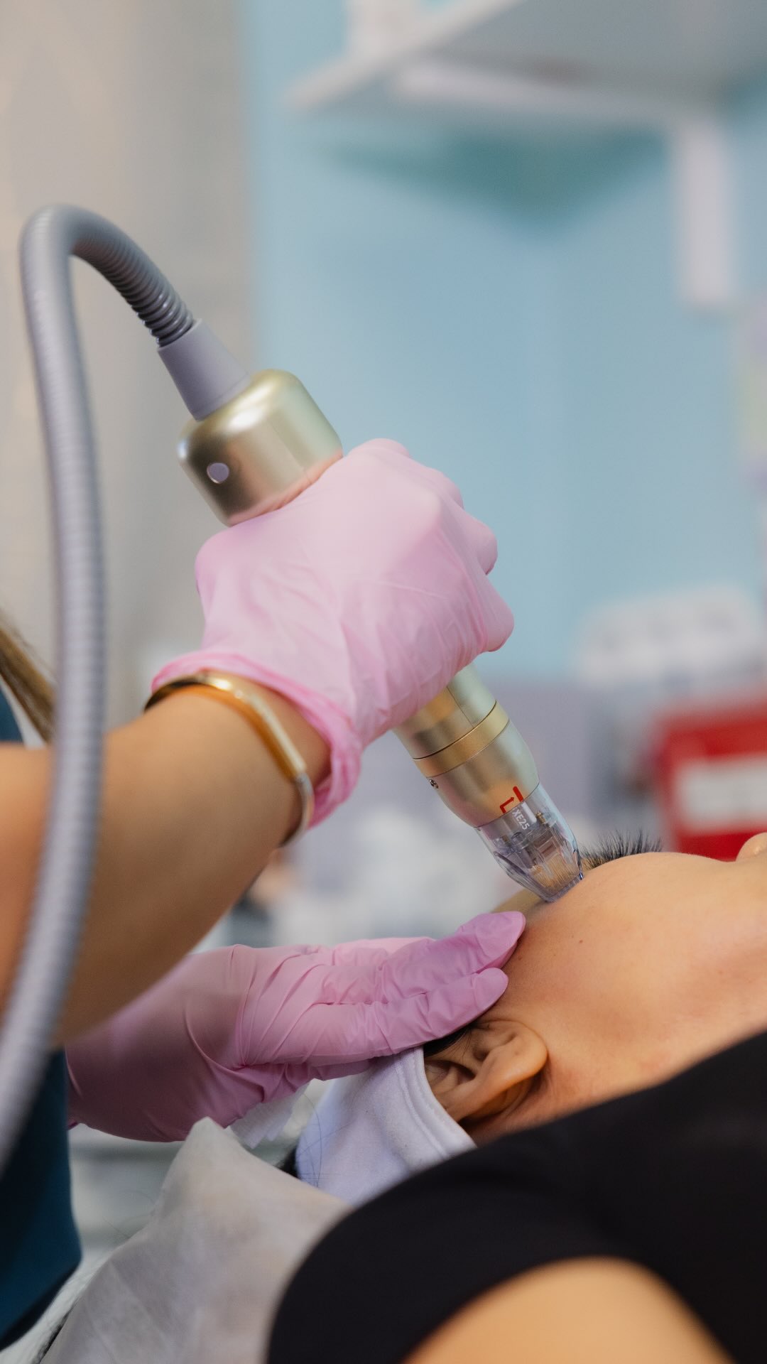 Microneedling is powerful. RF Microneedling? That’s next level. ⚡
Radiofrequency Microneedling combines the collagen-stimulating benefits of traditional microneedling with targeted RF energy delivered deep into the dermis.
What that means for you:
✨ Tighter, firmer skin
✨ Improved acne scars and texture
✨ Reduced pore size
✨ Lifted appearance without surgery
It’s one of our most popular treatments for clients who want real, visible results — and it works beautifully on all skin tones.
Ready to level up your skin? DM us or book a consultation. 💛
#rfmicroneedling #radiofrequencymicroneedling #skintightening #acnescartreatment #honoluluskincare medspahawaii rejuveaesthetics collagenboost