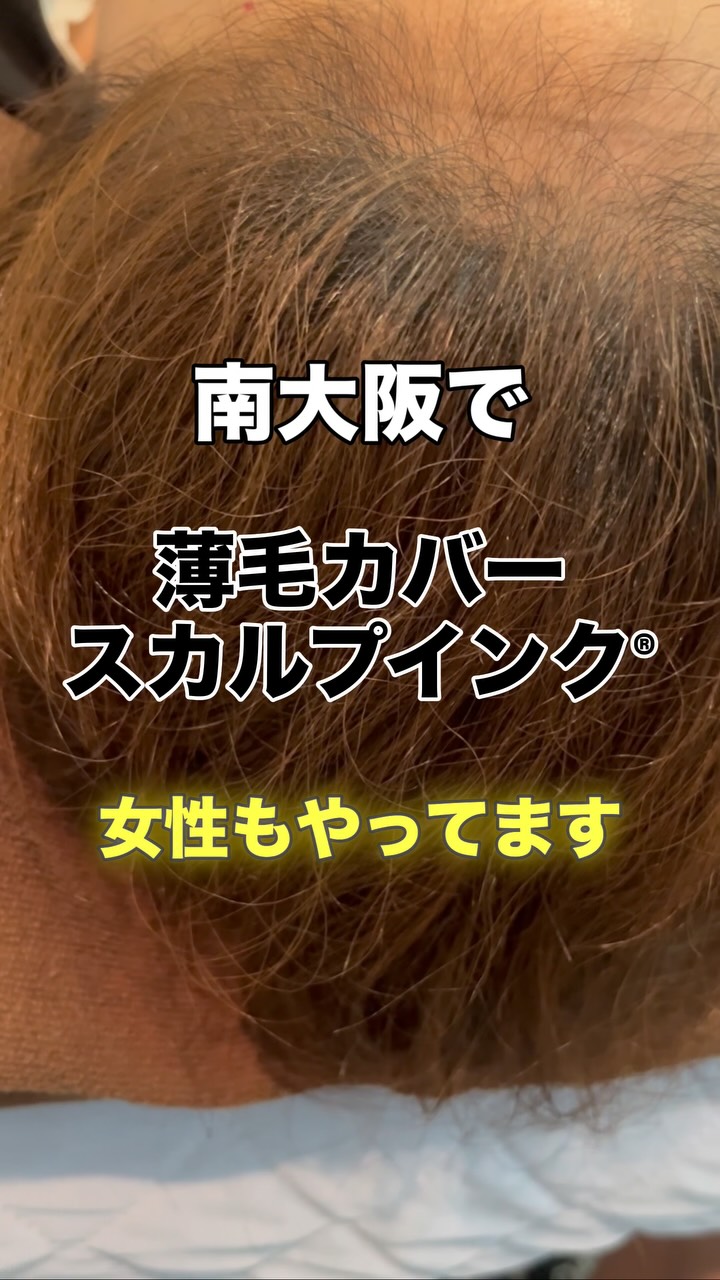 その薄毛、まずは“スカルプインク®“が自分に合うのか、から試しませんか?
当店では、皆様に安心して試していただけますように。初回施術で定着適性を見極め、万が一合わない場合は半額返金保証いたします。
無理に続けさせることはありません。結果に自信があるから、この仕組みです。
👉まずは“あなたに合うか”を確認してください。
【初回適正診断保証(半額返金)】
初回施術後、頭皮状態や色素の定着を確認し、当店基準で継続が難しいと判断した場合、初回施術費用の半額を返金いたします。
※以下の場合は対象外
・当店が継続可能と判断した場合
・お客様都合による中断など
・デザインの好みによる不満など
・アフターケア未実施など
──────────────────────
髪が薄くなると、見た目だけでなく気分まで沈みがち。
でも、もう一人で悩まなくて大丈夫です。
前髪・つむじ・分け目。
どこから見られても怖くない自然な仕上がりへ。
スカルプインク®は極小ドットで濃さを再現する
“最もバレにくい”頭皮タトゥー技術。
・痛みほぼなし/麻酔不要
・色落ちしにくい専用インク
・即日変化を実感/男女対応
産後脱毛・円形脱毛・傷跡にも対応。
──────────────────────
※美容師歴20数年の認定アーティストが責任を持って施術します。
※この地で開業18年となります、ご安心してお任せください。
大阪・和泉市|THREE BRANCHES
✨今なら3.3万発
49500円が33,000円(税込)
今なら何度でも‼️
📩公式LINEでご相談ください。
#スカルプインク
#薄毛対策
#南大阪
#つむじ
#頭皮タトゥー
※大阪で薄毛で悩まれている男性も女性も
ぜひ1度お声掛けください。