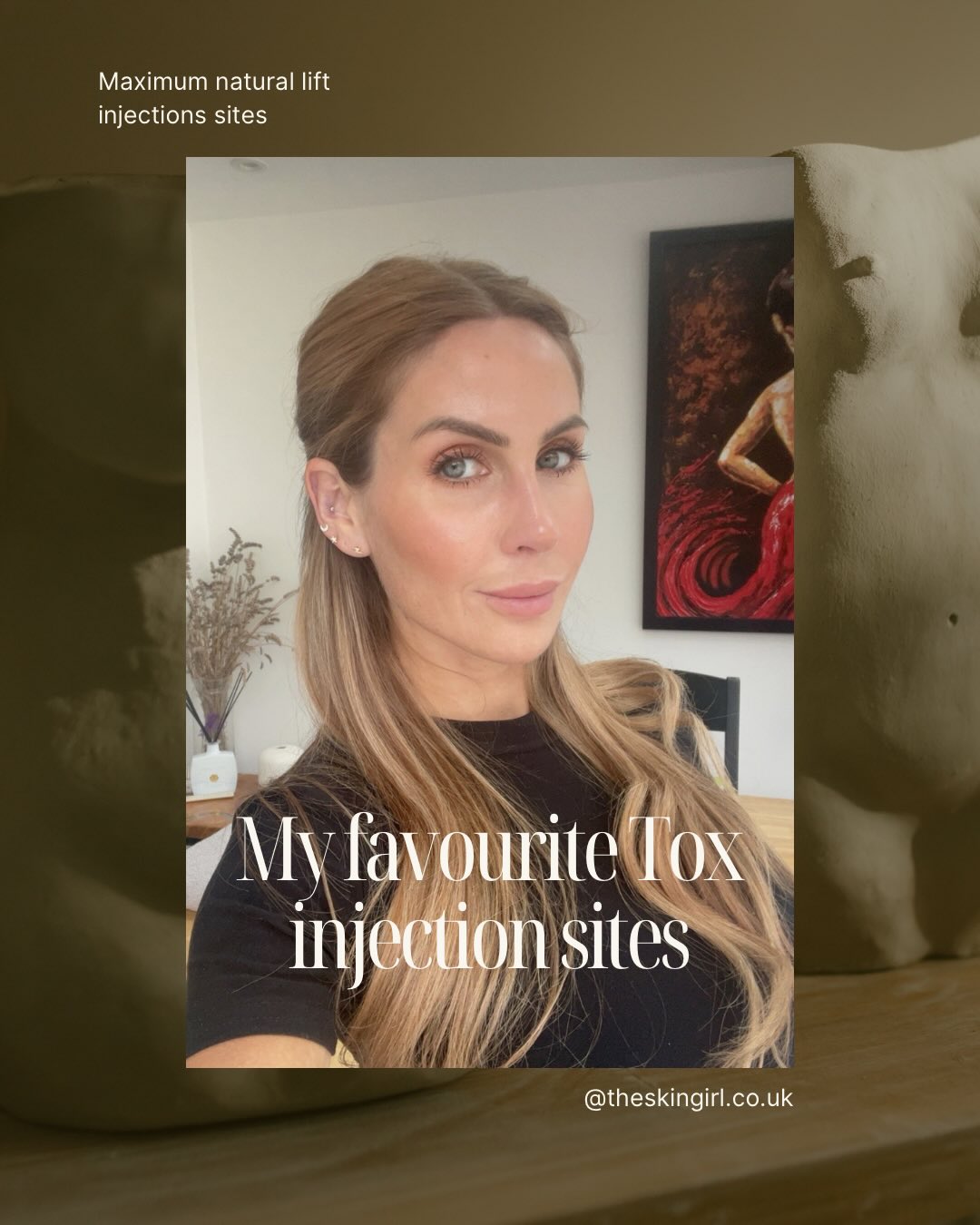 I just love it when the camera angle cuts off the top of my head, but here you go 🤦🏼♀️🤣
Some of my favourite injection points for maximum lift, smooth eyes and a natural lift to the lower face