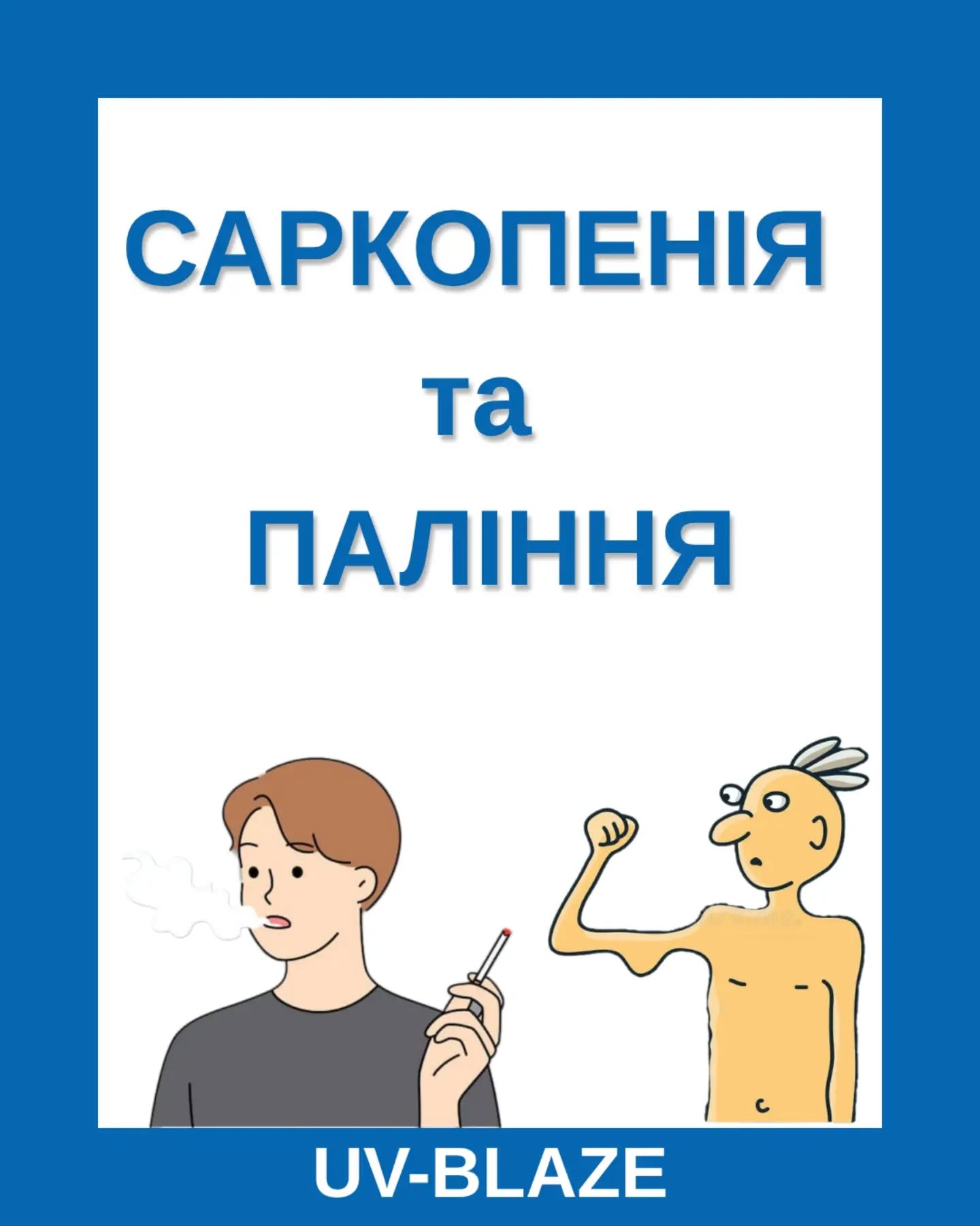 😲 Саркопенія - лише вікове захворювання чи...?
Саркопенія відома як прогресуюче генералізоване захворювання скелетних м'язів, що характеризується зменшенням м'язової маси, зниженням сили та фізичної працездатності. Окрім старіння, є також інші фактори, що впливають на втрату м'язів:
🔹️ Малорухливий спосіб життя;
🔹️ Недостатня кількість калорій та білку в раціоні;
🔹️ Зниження рівня гормонів;
🔹️ Запальний процес в організмі;
🔹️ Відчуття сильного стресу;
🔹️ Дефіцит вітаміну D (підвищує ризик розвитку саркопенії в 2,3 рази);
🔹️ Ожиріння;
🔹️ Паління.
Паління значно прискорює дегенерацію м'язів, оскільки провокувати системне запалення в організмі, що спричиняє активацію процесу розпаду м'язових білків. Характерні ознаки:
🔹️ Відчуття фізичної слабкості;
🔹️ Зменшення маси тіла;
🔹️ Повільна ходьба;
🔹️ Помітне, мивовільне скорочення м'язів;
🔹️ Порушення координації.
🏃♂️🏃♀️ Профілактика полягає у дотримуванні принципів здорового способу життя, фізичної активності, також у відмові (або, хоча б, зменшення обсягу) від шкідливих звичок, підтриманні достатнього рівня вітаміну D та білку (на добу вживати не менше 1,5-2 г білку / 1 кг маси тіла).
Пам’ятаймо, що рух - це життя 🌱
Будьте здорові! 🫶
#УФ #Україна #Здоров'я