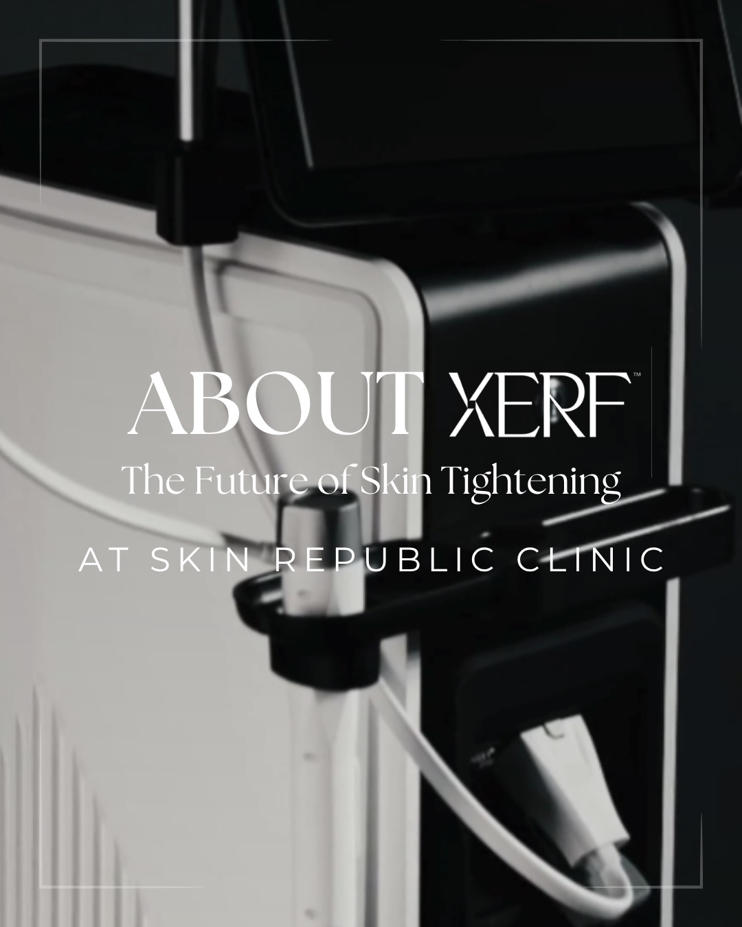 ✨ Meet the future of skin tightening. ✨
XERF is the world’s first multi-frequency monopolar RF treatment designed to target two skin layers involved in skin tightening and collagen support, all in one treatment.
Why we’re excited about XERF:
✔️ Targets two skin layers for comprehensive skin tightening
✔️ Stimulates collagen to improve firmness and support long-term skin health
✔️ Advanced cooling technology keeps the skin comfortable throughout treatment
✔️ Continuous AI-powered temperature monitoring ensures energy is delivered where it’s needed while maintaining a temperature that helps preserve facial fat and volume
✔️ No needles. No numbing. No downtime.
The result? Firmer, tighter, more sculpted skin while preserving the facial volume that contributes to a naturally youthful appearance.
Whether you’re looking to address skin laxity or take a preventative approach to aging, XERF is designed to help you achieve natural-looking results.
‼️ Our exclusive introductory offer is launching soon.
Comment “XERF” below to join the waitlist and be the first to know when bookings open.
#xerf #skintightening #saggingskin #structuraltightening #northyorkskinclinic