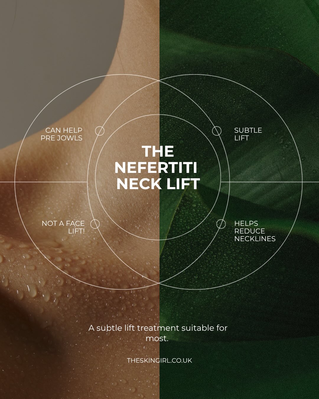 I was going to do half of my face, but feared I may look slightly odd during my clinic days and have to repeat the same conversation over and over that it is just for social media 🤣🤣
The Nefertiti Neck Lift is one of the most elegant ways to redefine the jawline and soften the appearance of the neck—without surgery.
By strategically relaxing the muscles that pull the lower face downwards, this treatment can help:
• Create a more defined jawline
• Improve the appearance of neck bands
• Lift the lower face
• Restore a smoother, more youthful profile
Results develop gradually over 1–2 weeks, leaving you looking refreshed, never overdone.
If you’ve started to notice loss of definition around the jawline or changes in your neck, this could be an excellent treatment option.
📍 St Mellons (Flagship Clinic)
📍 Chepstow
📍 Gloucester
Book online via the link in our bio or WhatsApp us for more information or to arrange a free consultation
Hopefully this can give you an insight into if it may be inappropriate treatment for you #
R x