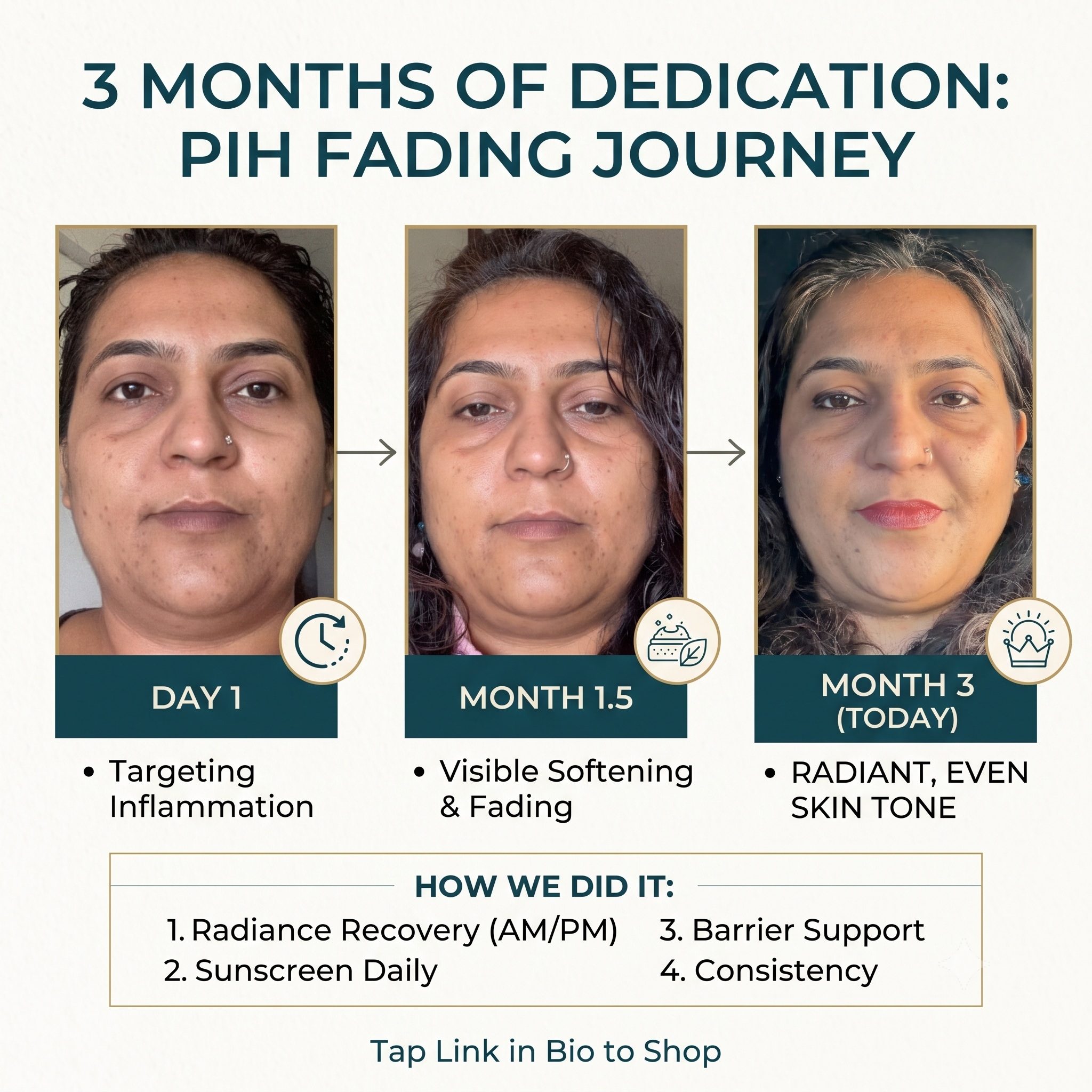 Post-inflammatory hyperpigmentation (PIH) is persistent, but the right approach can be powerful. Our client didn't use harsh chemicals or rapid peels—she used consistent, barrier-supporting care over three months. #SkinTransformation #PIHJourney #FadeDarkSpots #skinbarrierhealth #skincarecommunity #radiancerecovery #beforeandafter #realresults #evenskintone
