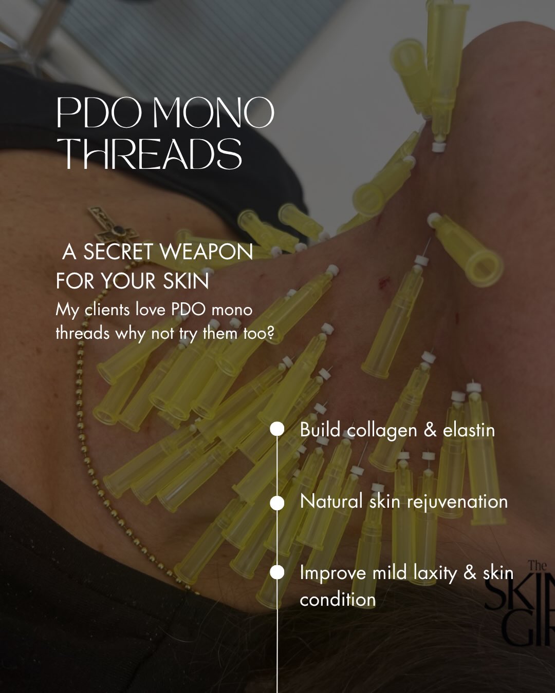 PDO Mono Threads — these little beauties are subtle, regenerative and designed to work with your skin.
By stimulating your own collagen, they help improve firmness, texture and skin quality over time for a naturally refreshed result.
A celebrities best kept secret!
Complimentary consultations available.
Book online via the link in bio.