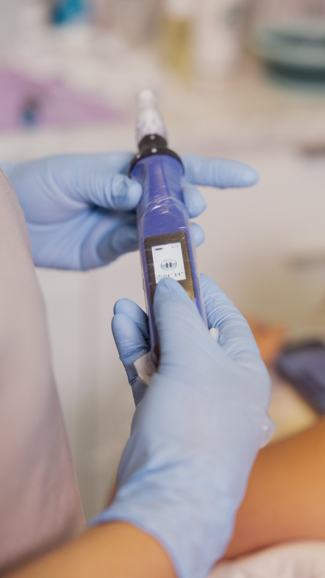 Microneedling and Microchanneling may sound similar—but they serve different purposes. ✨
Both treatments create controlled micro-injuries in the skin to support renewal, but the depth and treatment goals are different.
💉 Microneedling
Designed to reach deeper into the skin, microneedling helps stimulate collagen and elastin production. It’s often recommended for concerns like:
• Acne scars
• Fine lines and wrinkles
• Uneven texture
• Overall skin rejuvenation
✨ Microchanneling
Microchanneling creates more superficial channels in the skin, making it an excellent option for enhancing the delivery of professional skin boosters and topical treatments while supporting a healthy, radiant complexion with minimal downtime.
The best treatment depends on your skin, your concerns, and your goals—not what’s trending.
That’s why every consultation at Rejuvé starts with understanding your skin first, then creating a personalized treatment plan.
Save this post for the next time someone asks, “What’s the difference?” 📌