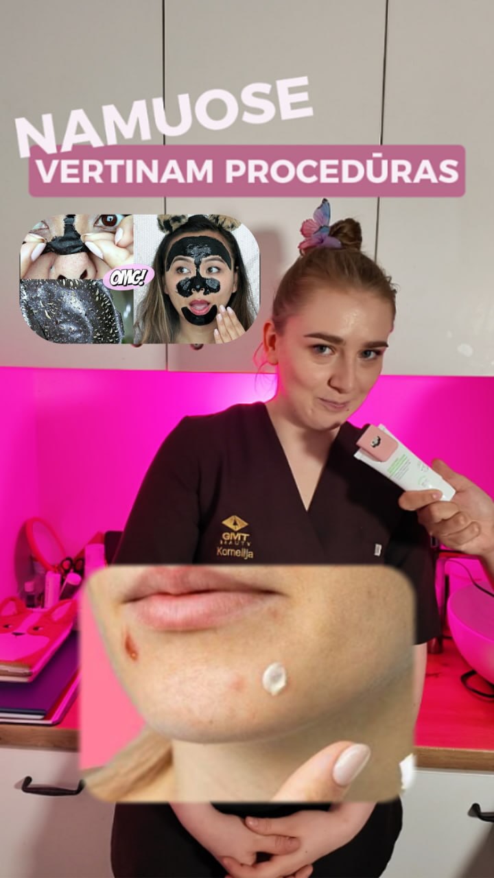Vienintelis trendas kurį noriu kad pasiimtumėt iš socialinių tinklų - kasdienis SPF naudojimas ir tvarkingas reaplikavimas 💗
Oda yra didžiausias Jūsų organas ir jai tikrai nereikia eksperimentavimo 🧪🔬
Nori nebespėlioti kas Tavo odai padės? Pasek mano profilį @kornelija_kolagenas ir čia rasi veiksmingus ir lengvus odos priežiūros patarimus ✨
#veidopriežiūra #veidoprocedūros #odosprieziura #kosmetologe