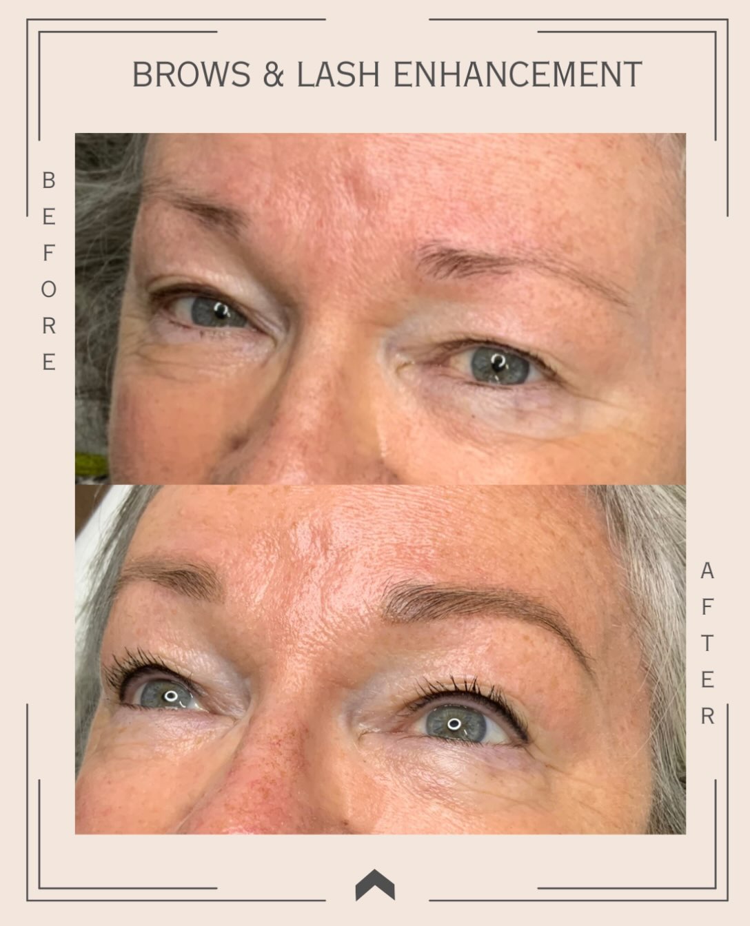 Subtle, but enough to make a difference…”
…is what I’m asked for more than anything - and this is exactly what that looks like! 💁🏻♀️
Soft powder brows + top lash enhancement are the perfect combo…
A little more shape & definition through the brows, paired with a subtle top lash enhancement to frame these pretty eyes and make them appear brighter.
👉 This before & after perfectly demonstrates my signature style.
Friends might notice you’re looking fresher… a little different… but they won’t be able to put their finger on what’s changed.
And they certainly wouldn’t guess it's tattooing! 🙌
That’s always my aim with permanent makeup - enough to make a real difference, but never so much that it gives the game away.
You still look completely like you… just fresher, and with that little boost of confidence that puts a spring in your step! ✨
Free consultations - message me to book at your nearest clinic:
📍Dermal Elitee, Musselburgh
📍Debonair Salonn, Kendal