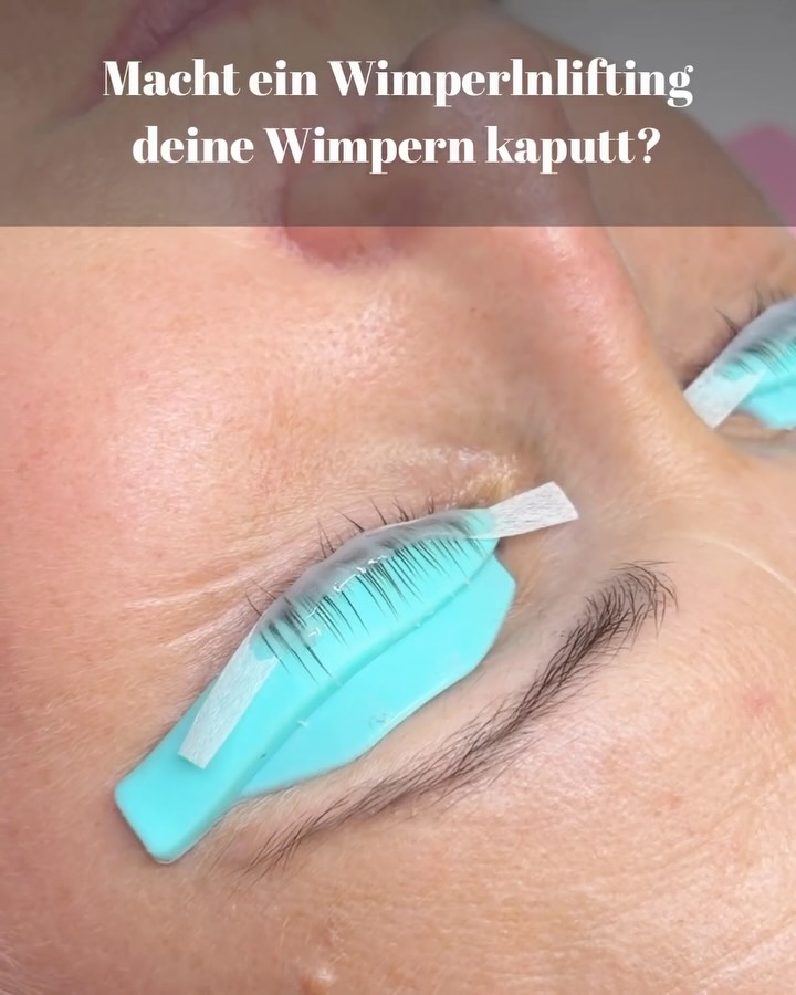 Macht ein Wimpernlifting deine Wimpern kaputt? 👀
Diese Frage höre ich tatsächlich öfter.
Und die kurze Antwort ist: Nein – ein richtig durchgeführtes Wimpernlifting sollte deine Wimpern nicht kaputt machen.
Aber genau hier liegt der Punkt.
Wenn die Wimpern nach dem Lifting plötzlich trocken aussehen, sich stark kringeln, kreuzen oder einzelne Wimpern komplett in unterschiedliche Richtungen stehen, dann kann etwas bei der Behandlung nicht optimal gelaufen sein.
Zum Beispiel, wenn die Einwirkzeit nicht zur Wimper passt oder die Wimpern zu stark geliftet wurden.
Gerade bei sehr feinen oder bereits strapazierten Wimpern muss man besonders vorsichtig arbeiten.
Ein schönes Lifting bedeutet für mich deshalb nicht einfach „so hoch wie möglich“.
Es soll zur Naturwimper passen – und vor allem soll sie danach noch gesund und schön aussehen. 🤍
Du hattest schon einmal ein Wimpernlifting und danach waren deine Wimpern plötzlich total verdreht oder trocken?
Dann erzähl mir gerne davon. 👇
#wimpernlifting #lashlifting #lashlift #wimpern #salzburg